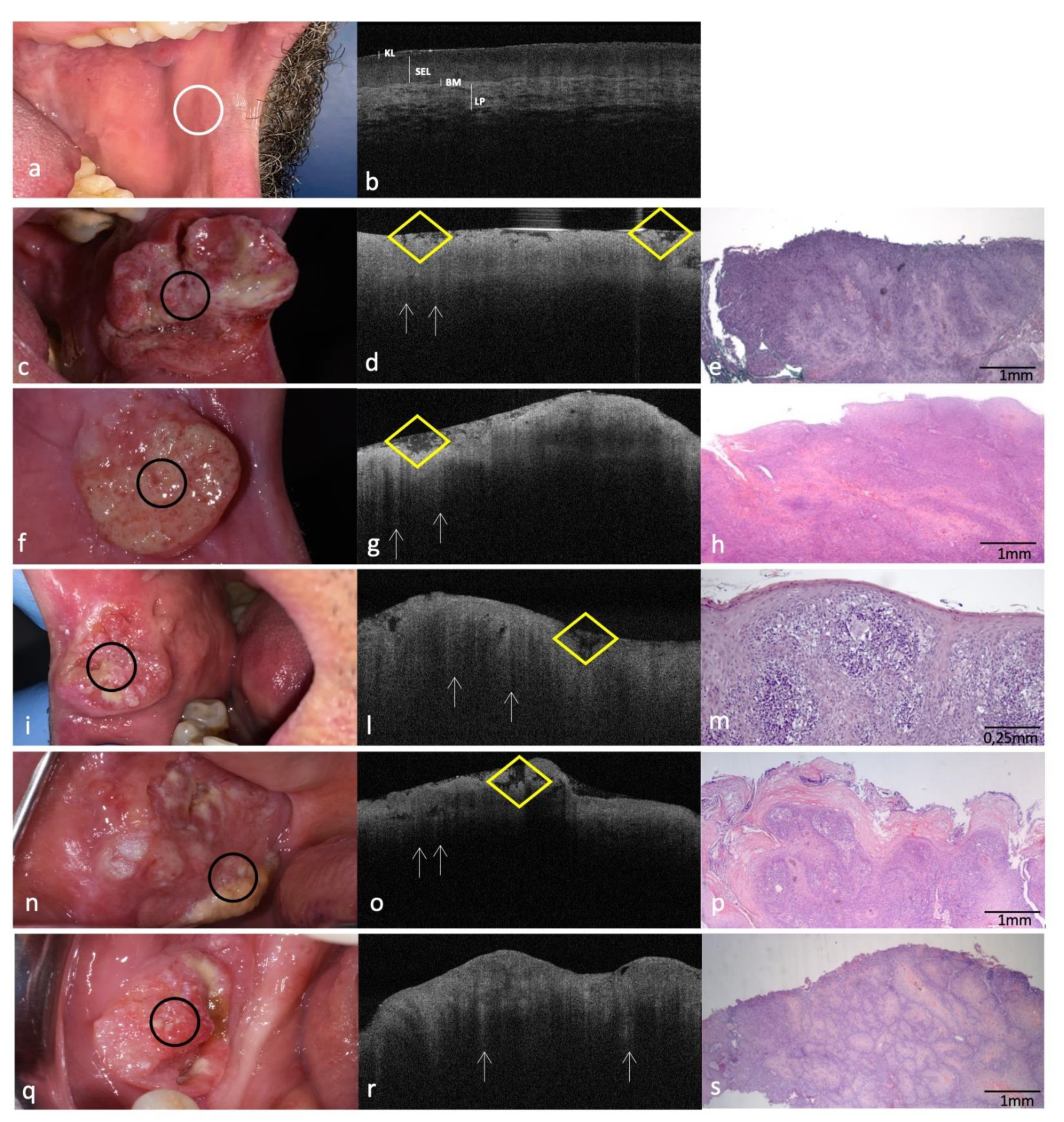 Cancers 14 05916 g005