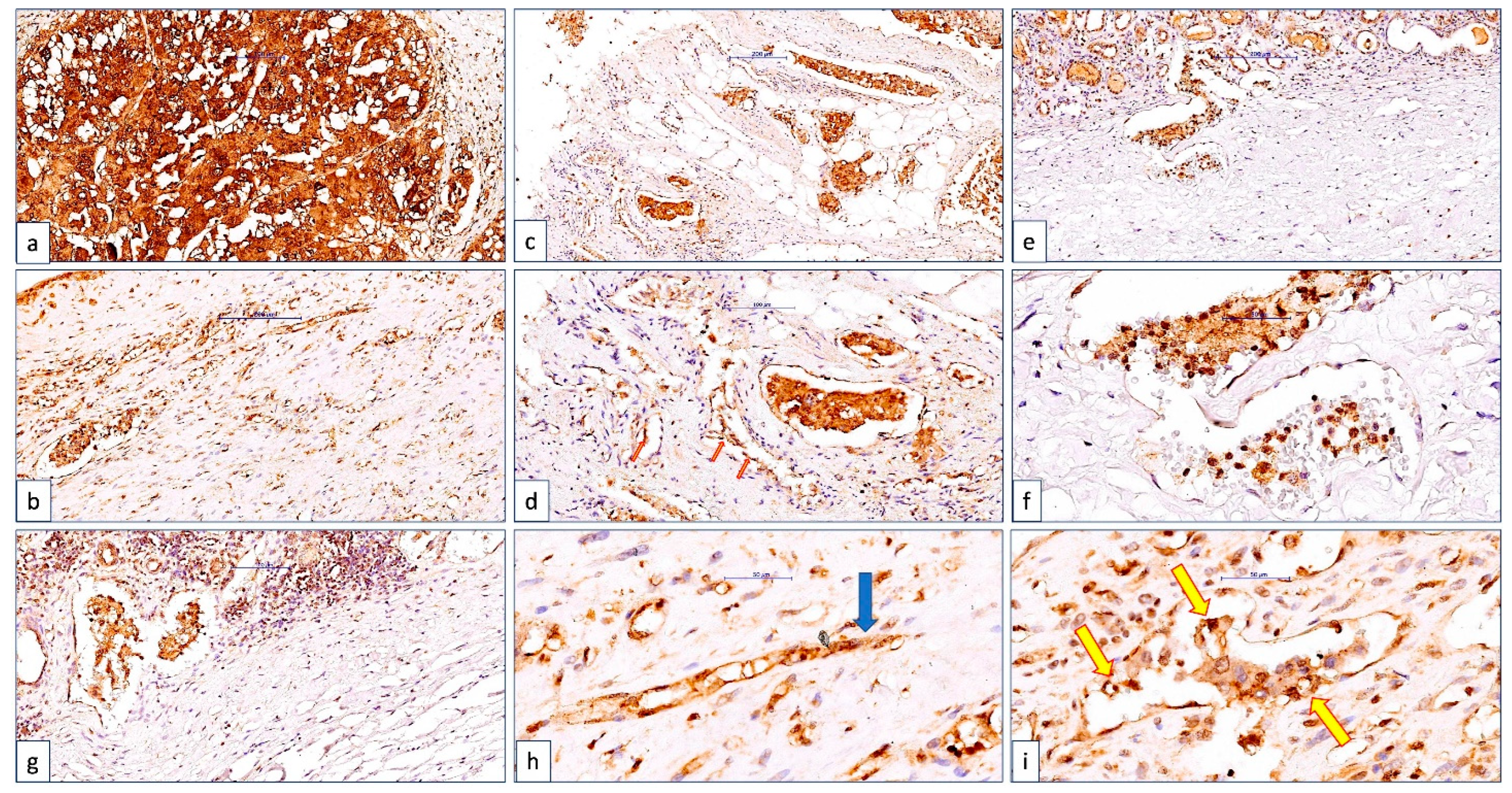 Cancers 14 05981 g004 Cancers 14 05981 g004