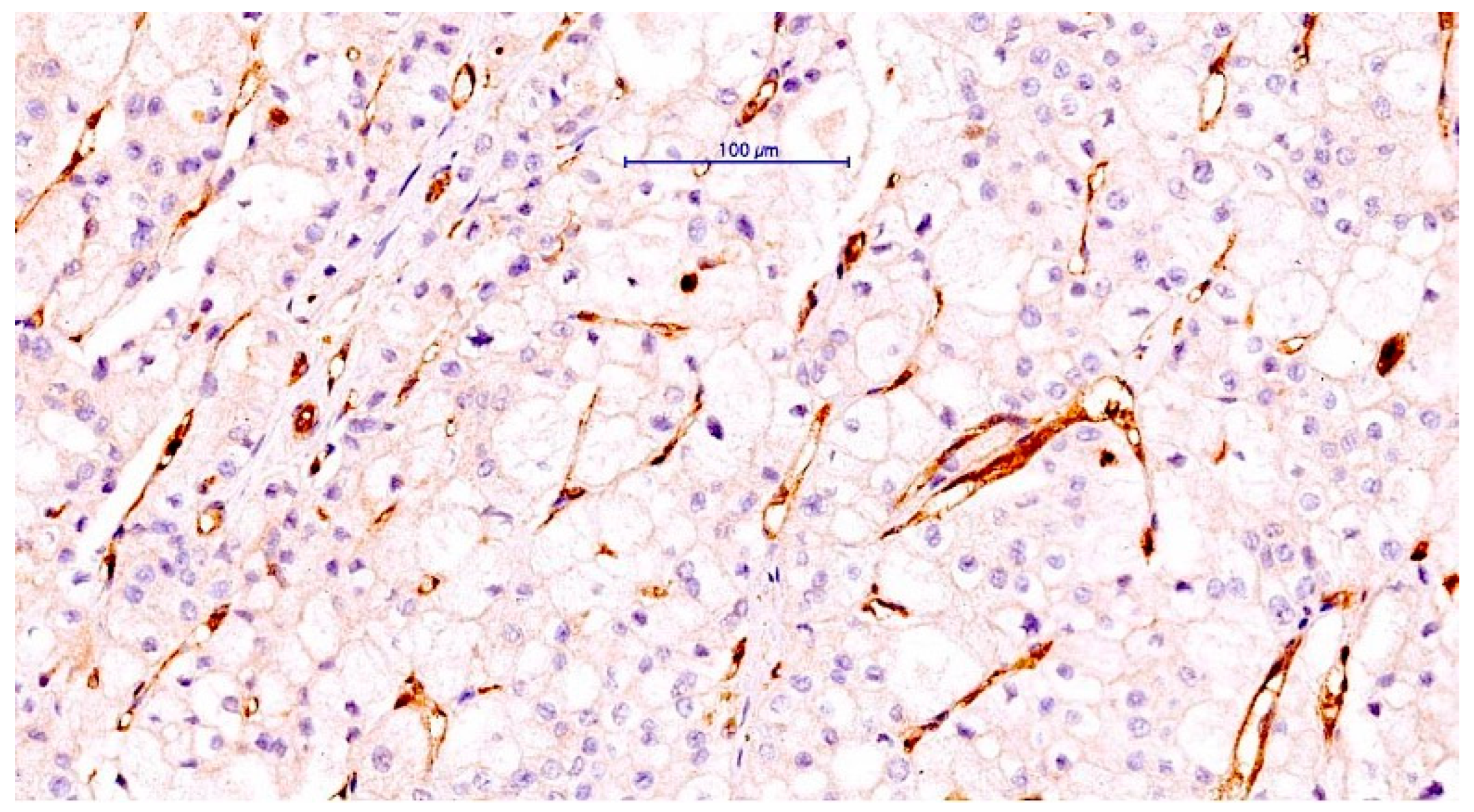 Cancers 14 05981 g005 Cancers 14 05981 g005