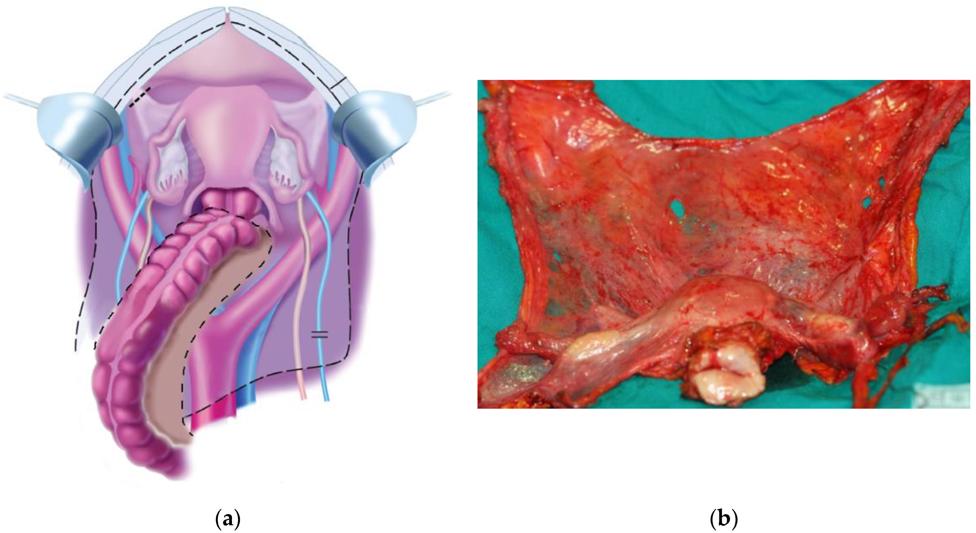 Cancers 14 06010 g001