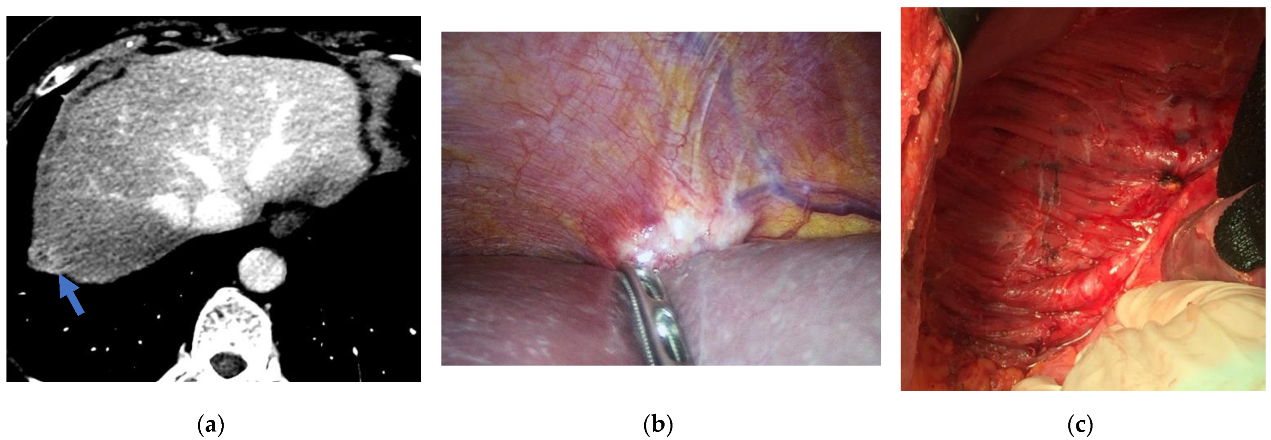 Cancers 14 06010 g002