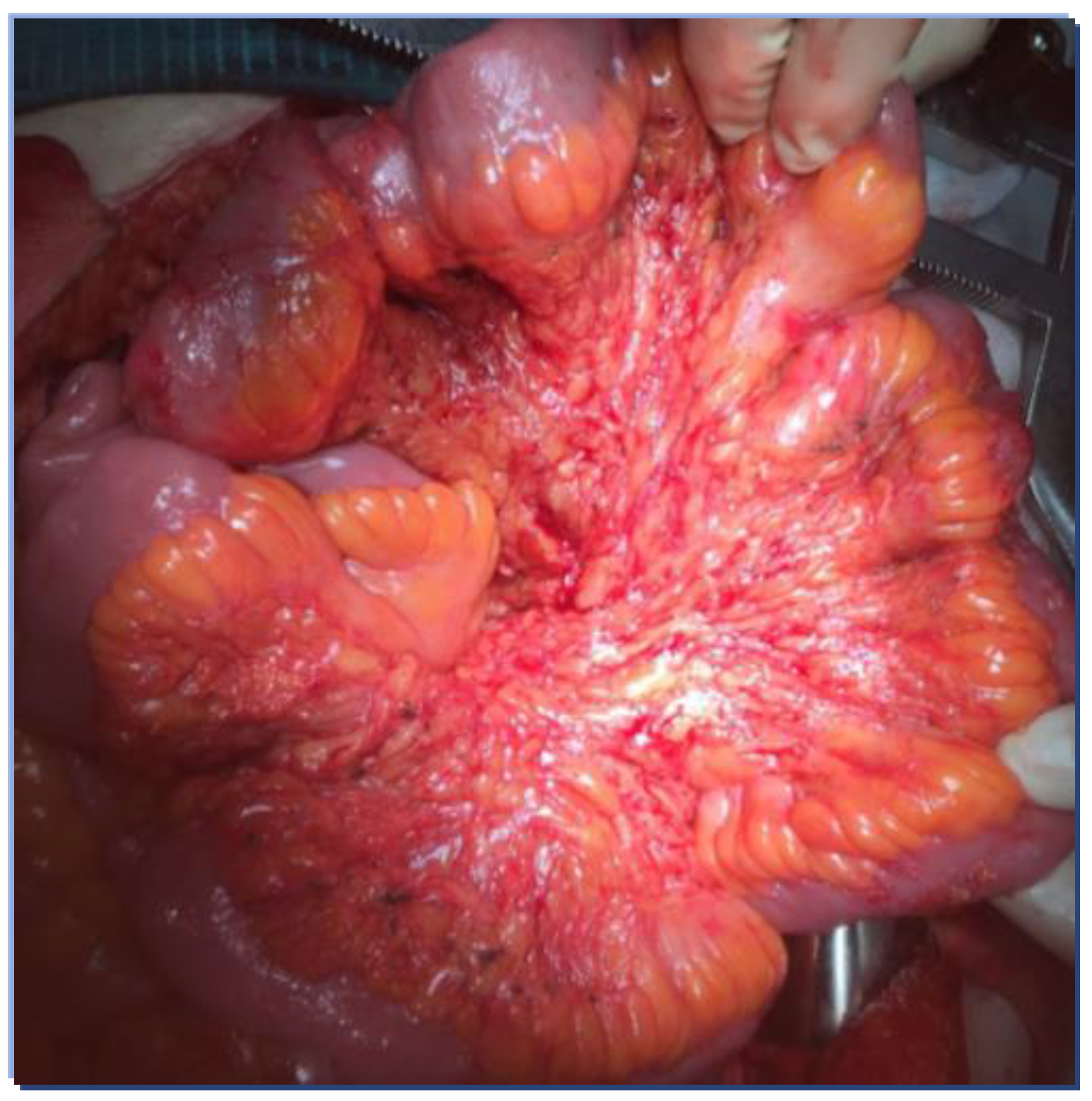 Cancers 14 06010 g003