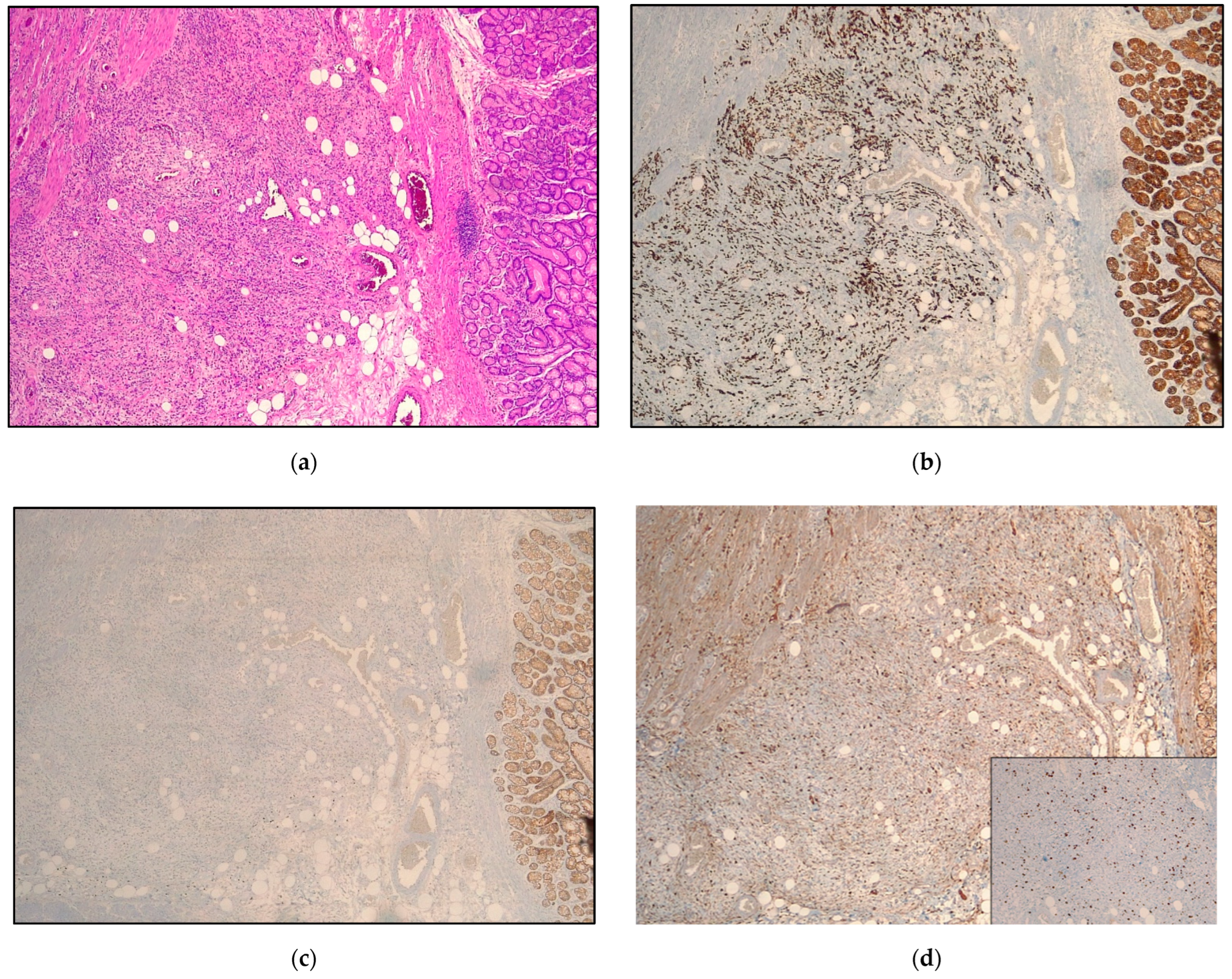 Cancers 14 06023 g001 Cancers 14 06023 g001