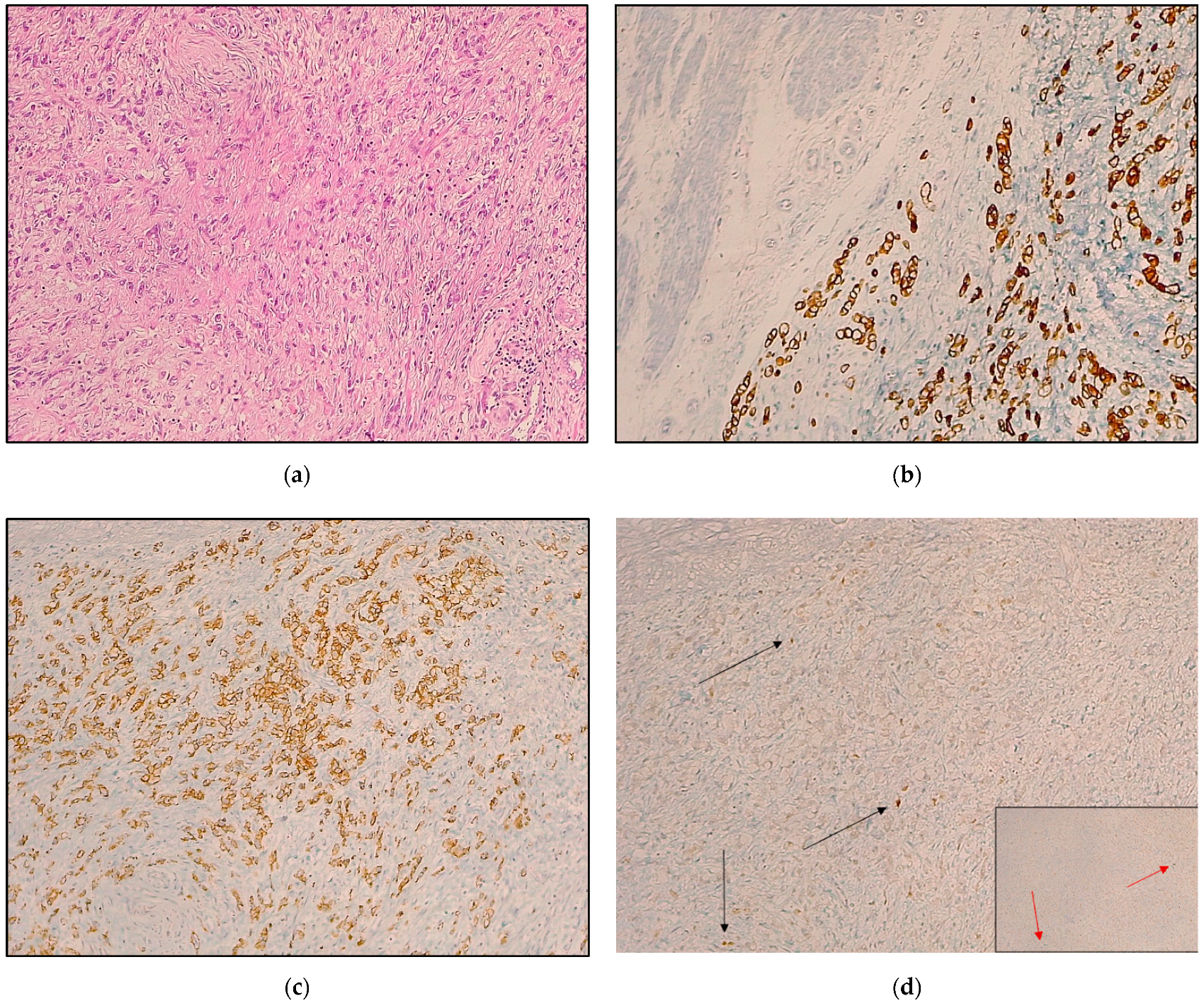 Cancers 14 06023 g002 Cancers 14 06023 g002