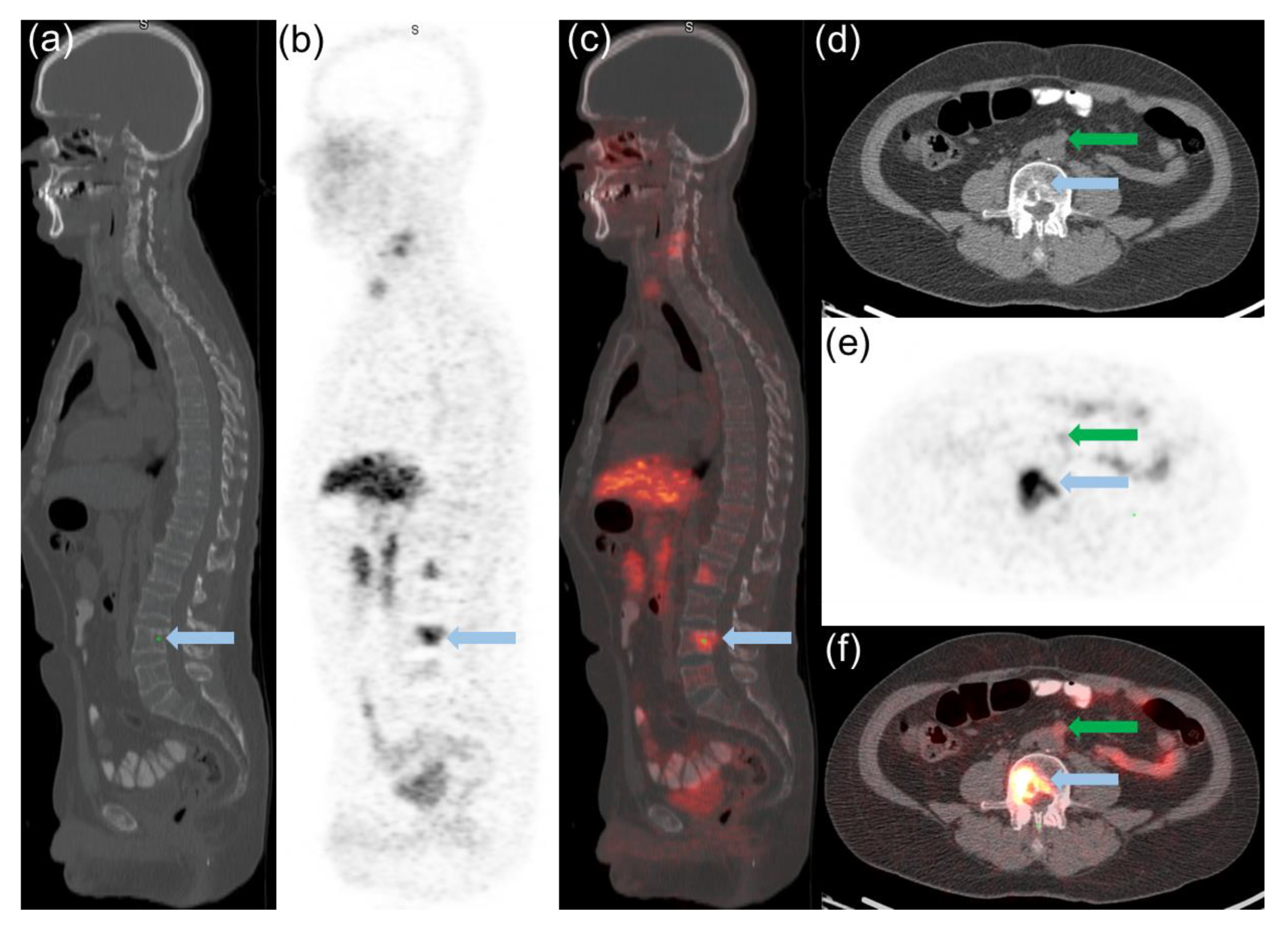 Cancers 14 06039 g002 Cancers 14 06039 g002