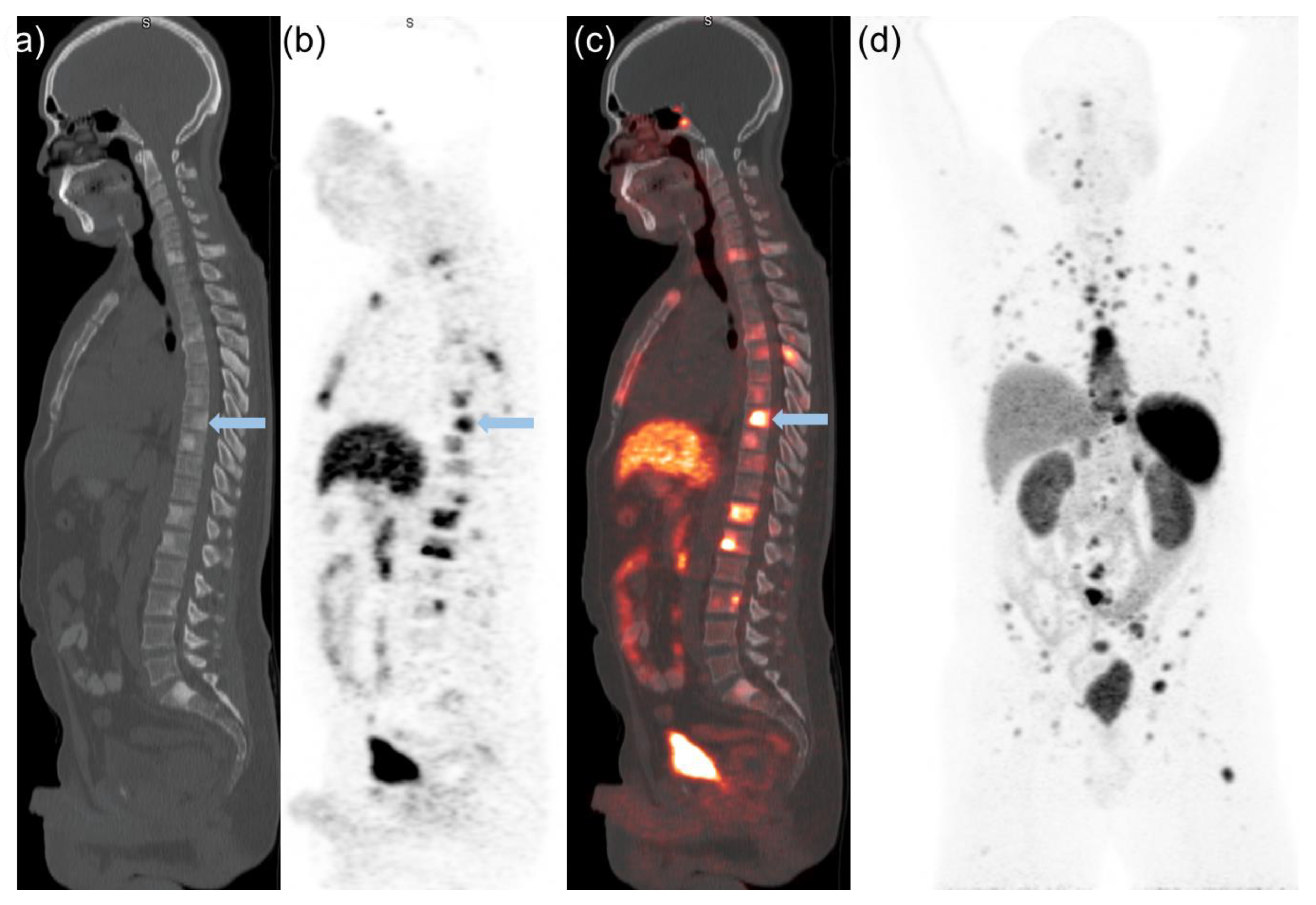 Cancers 14 06039 g003 Cancers 14 06039 g003