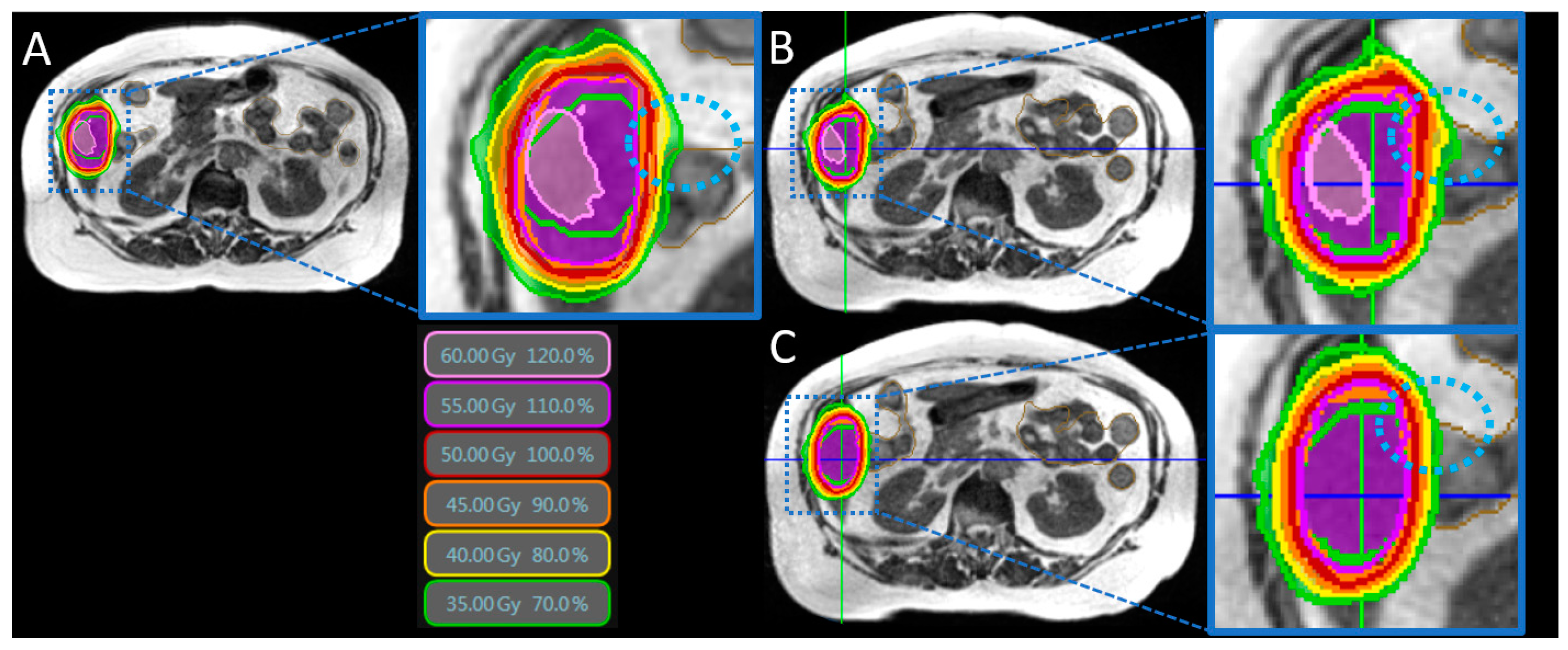 Cancers 14 06041 g001 Cancers 14 06041 g001