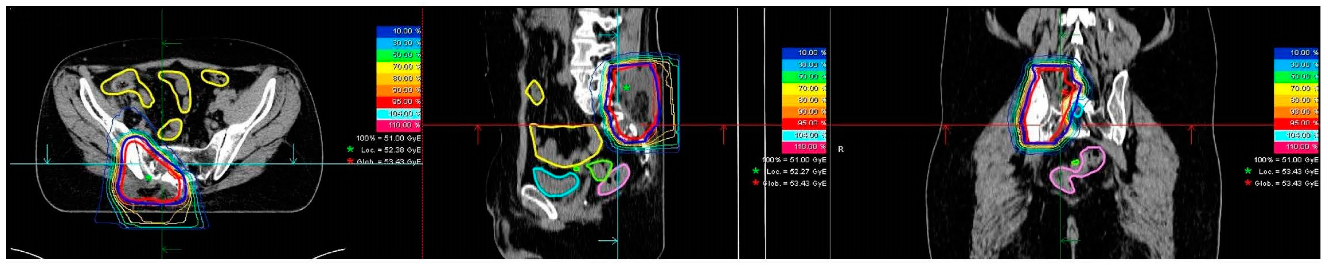 Cancers 14 06045 g002