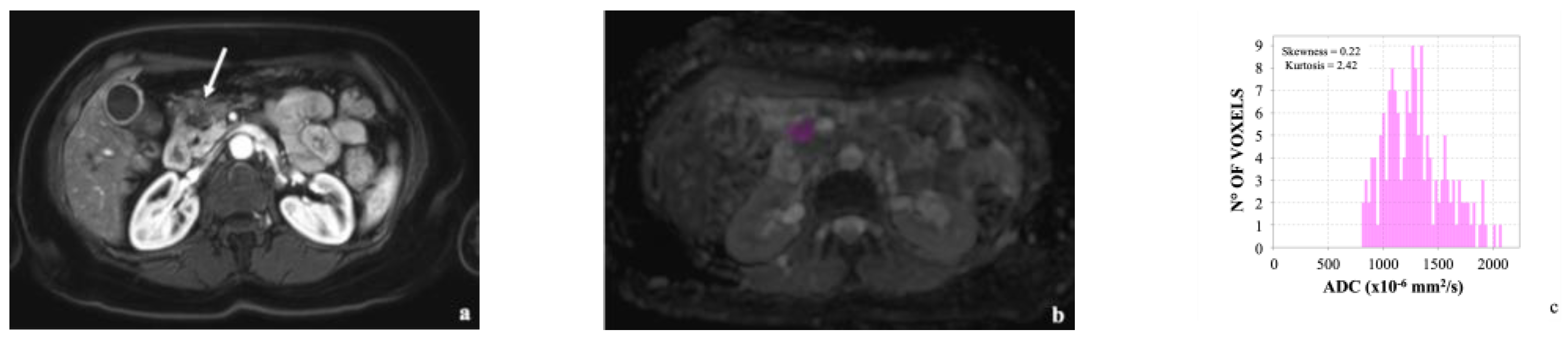 Cancers 14 06050 g001 Cancers 14 06050 g001