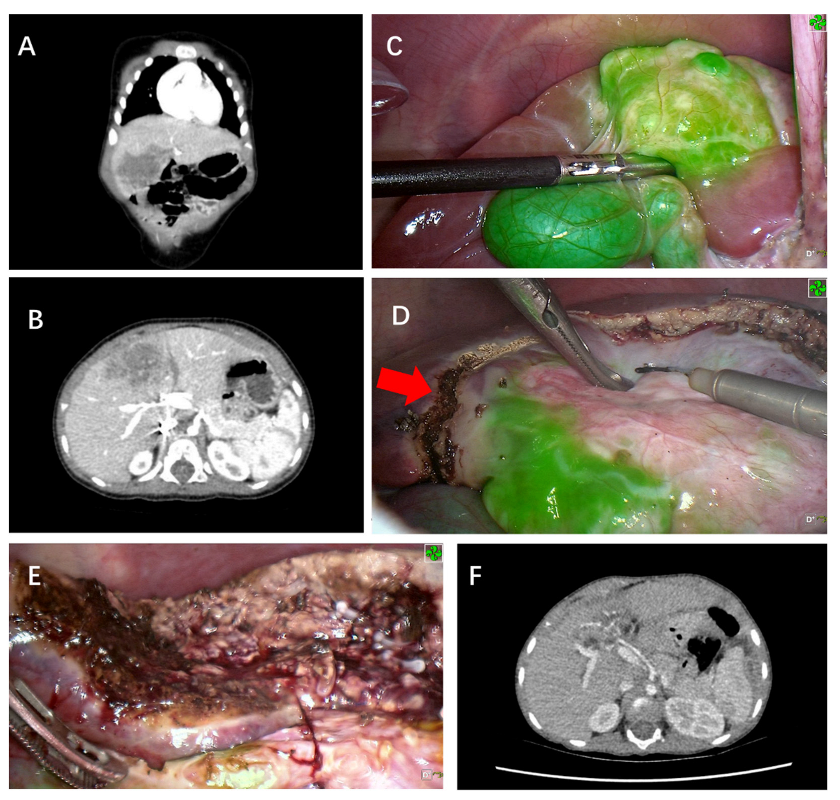 Cancers 14 06057 g001 Cancers 14 06057 g001