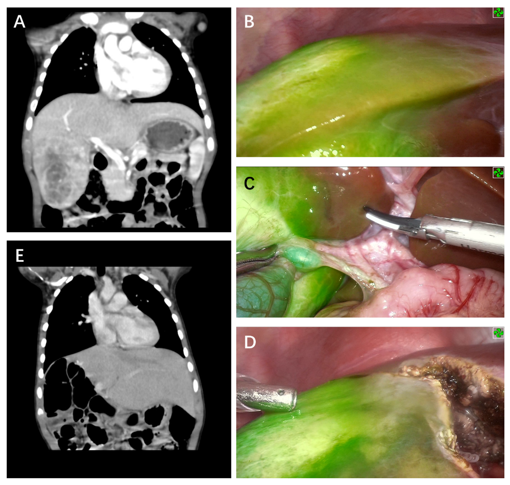 Cancers 14 06057 g002 Cancers 14 06057 g002