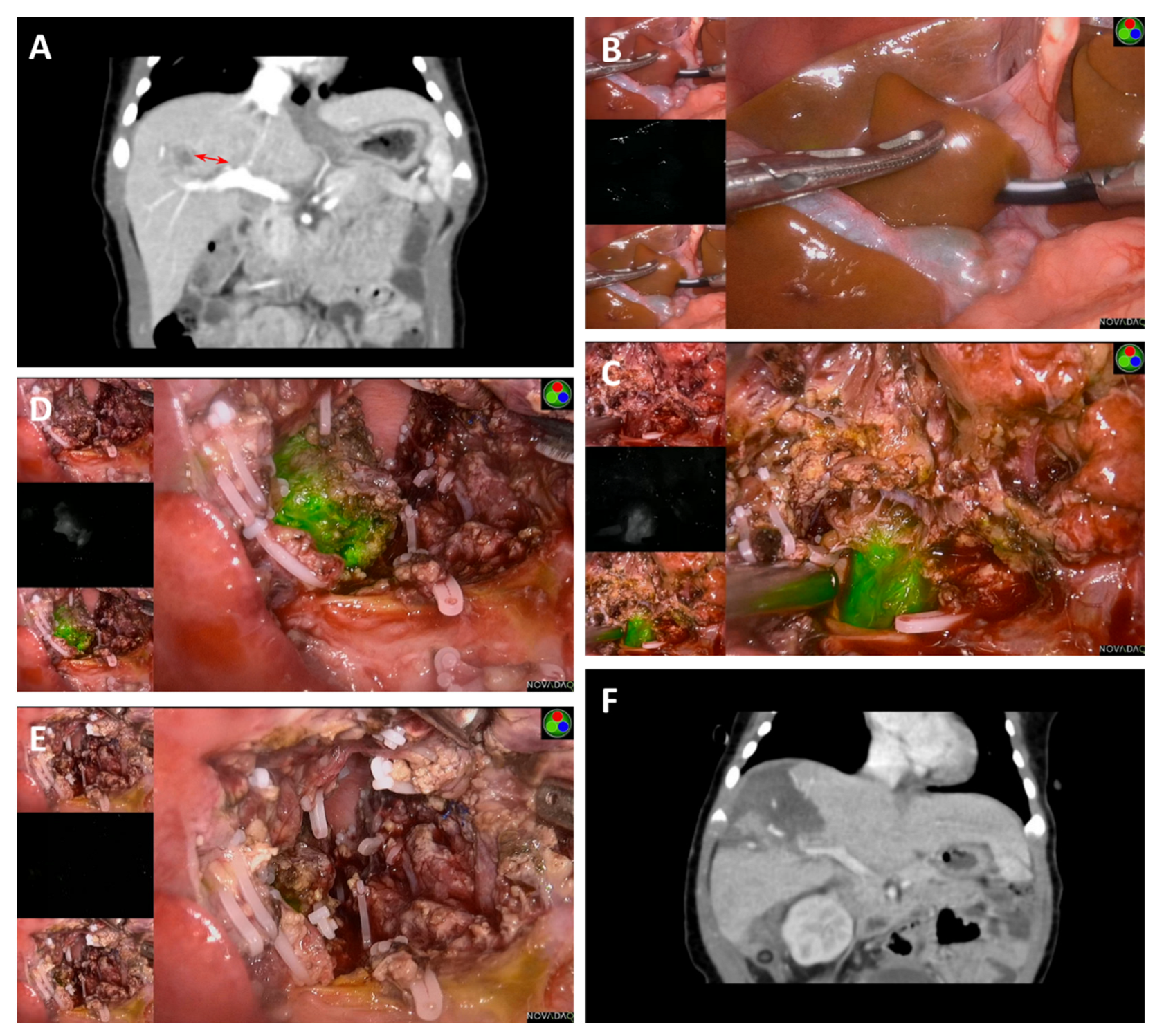 Cancers 14 06057 g004 Cancers 14 06057 g004