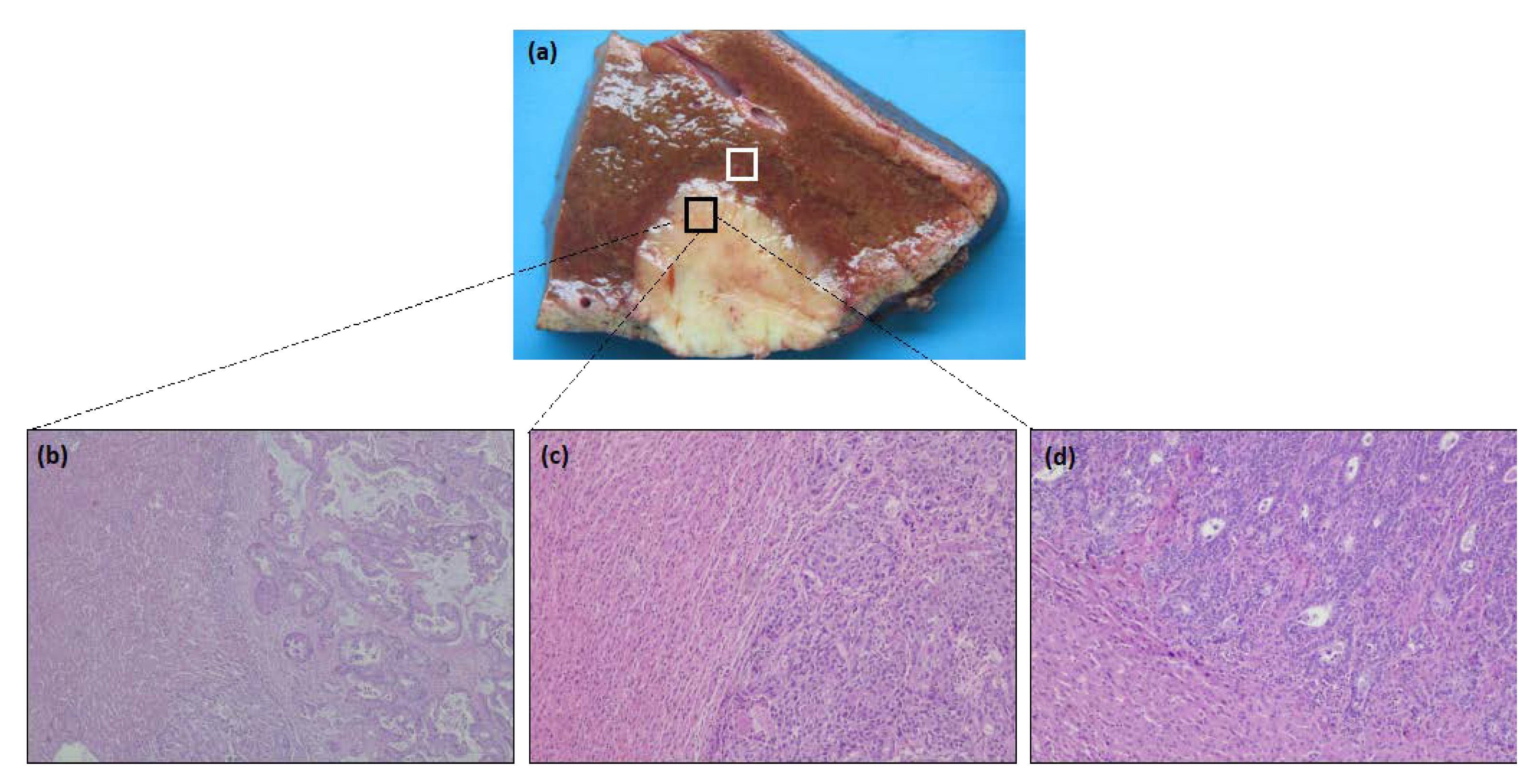 Cancers 14 06069 g001