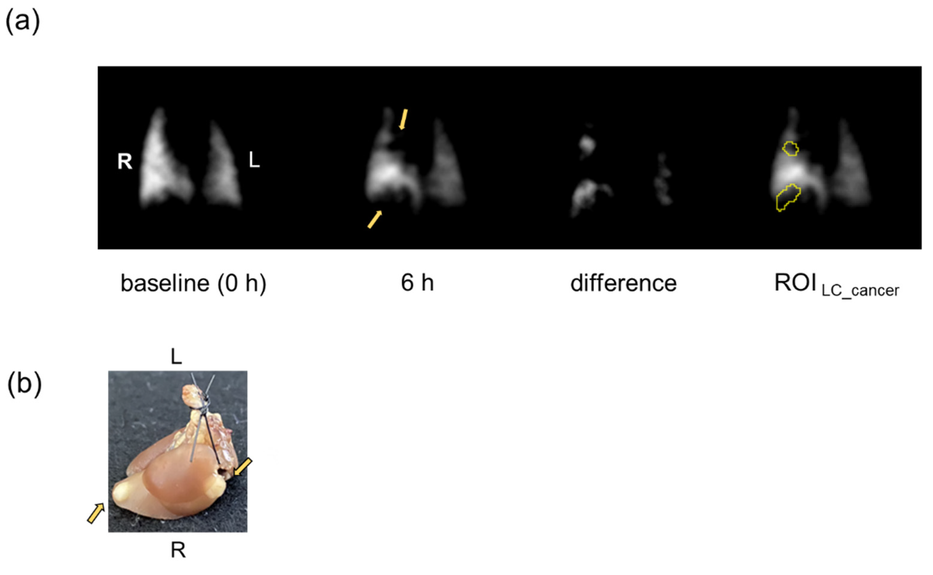 Cancers 14 06070 g001