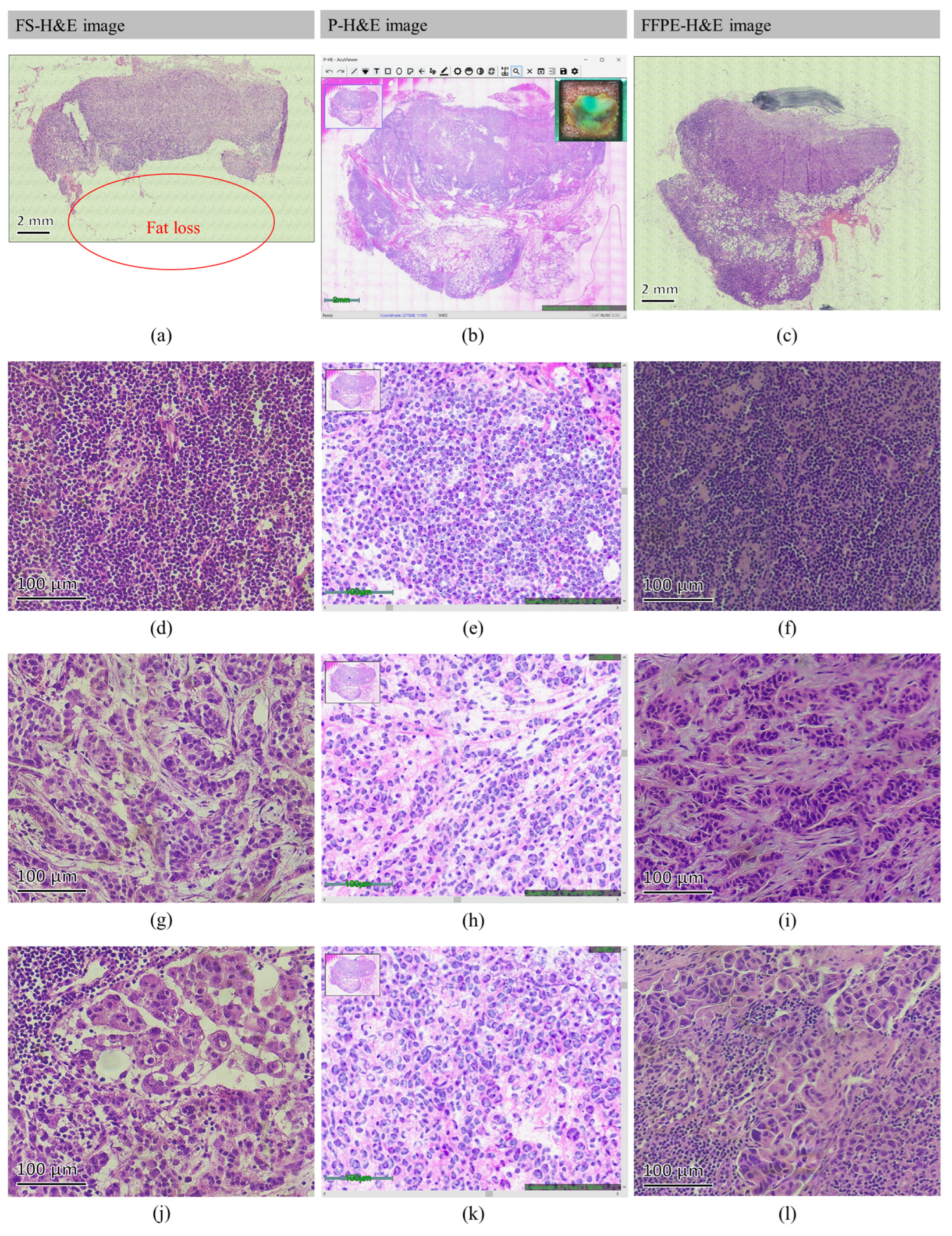 Cancers 14 06081 g005 Cancers 14 06081 g005