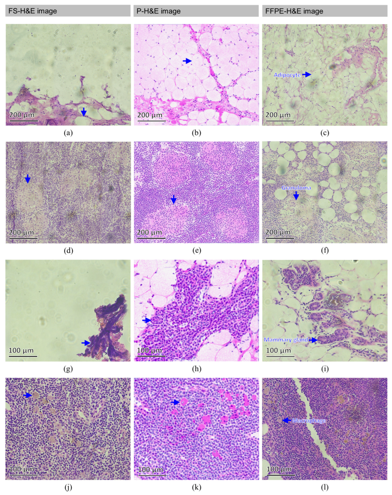 Cancers 14 06081 g006 Cancers 14 06081 g006