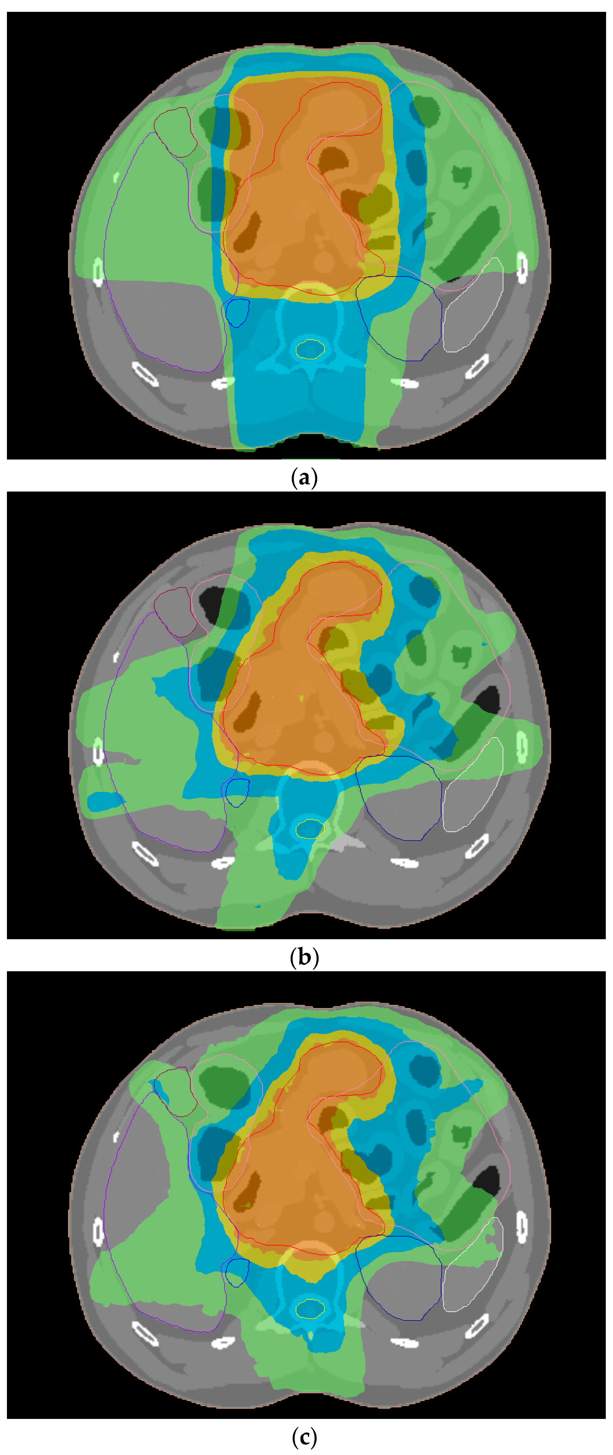 Cancers 14 06098 g004 Cancers 14 06098 g004