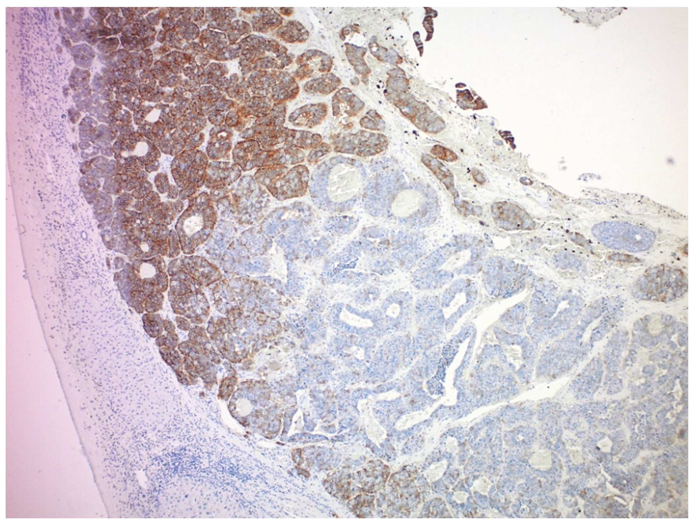 Cancers 14 06114 g004