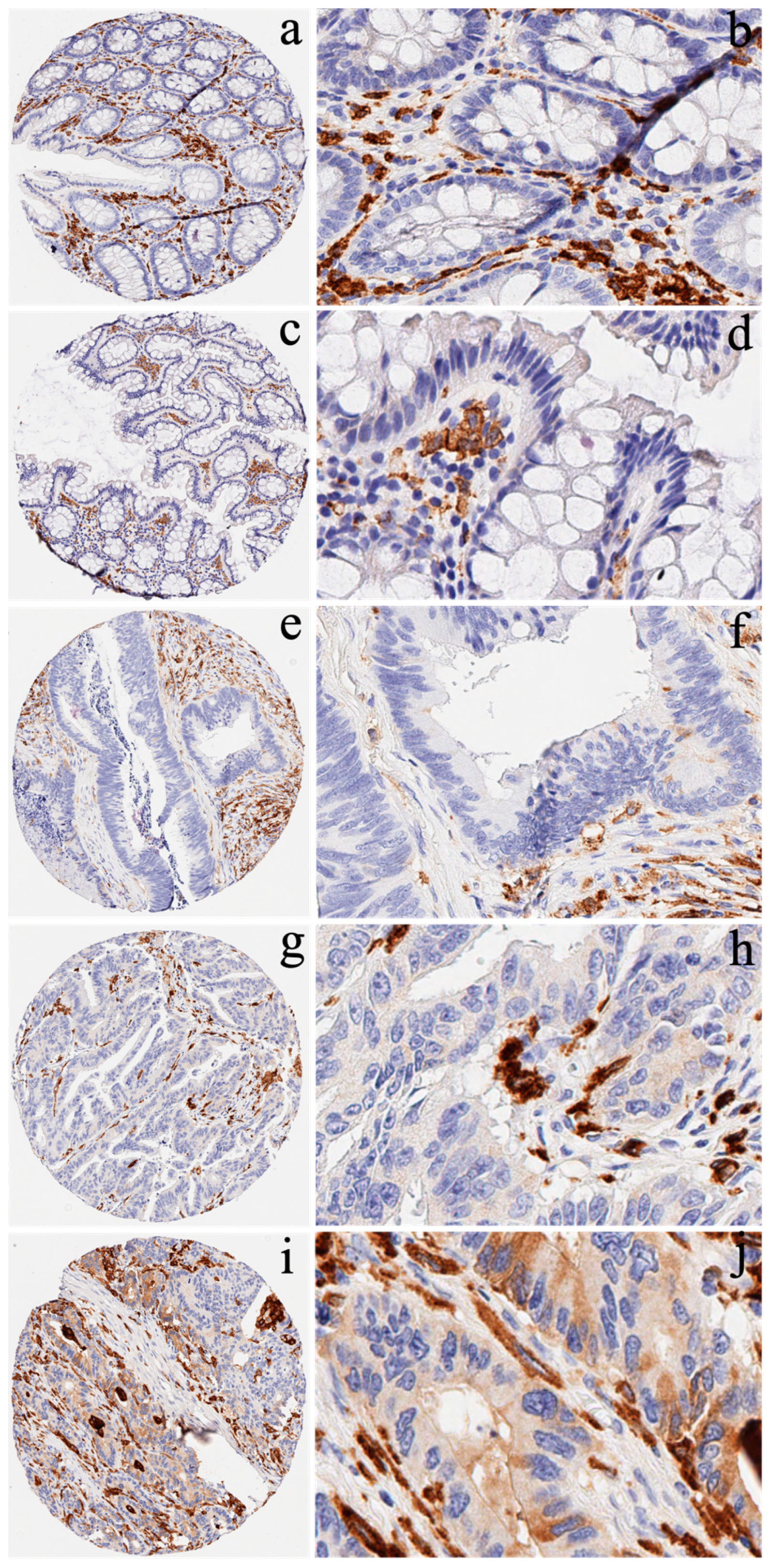 Cancers 14 06166 g002 Cancers 14 06166 g002