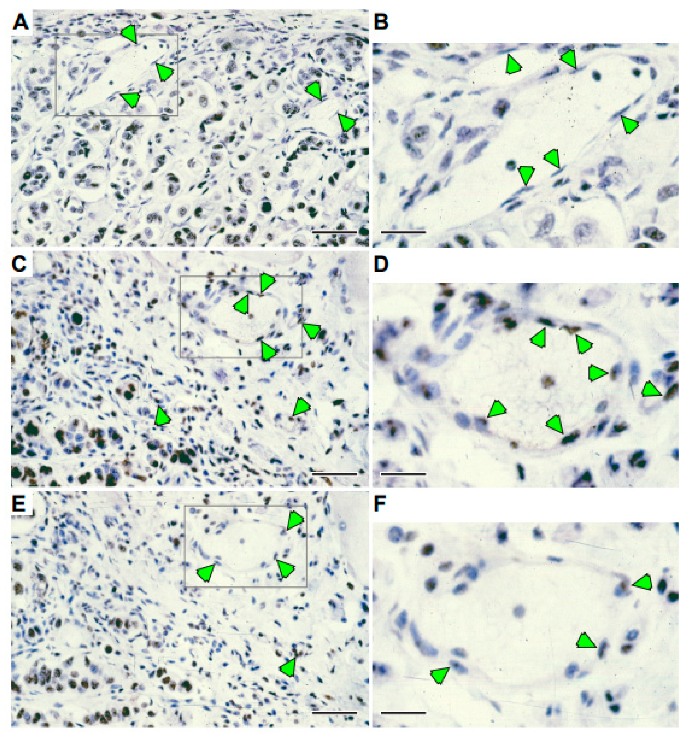 Cancers 14 06175 g006 Cancers 14 06175 g006