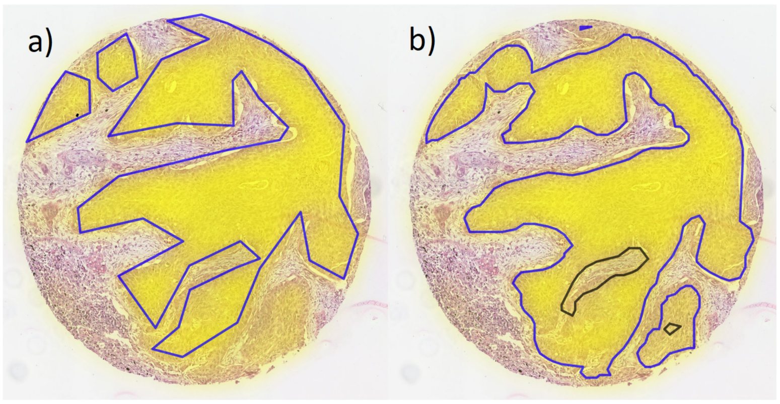Cancers 14 06181 g002 Cancers 14 06181 g002