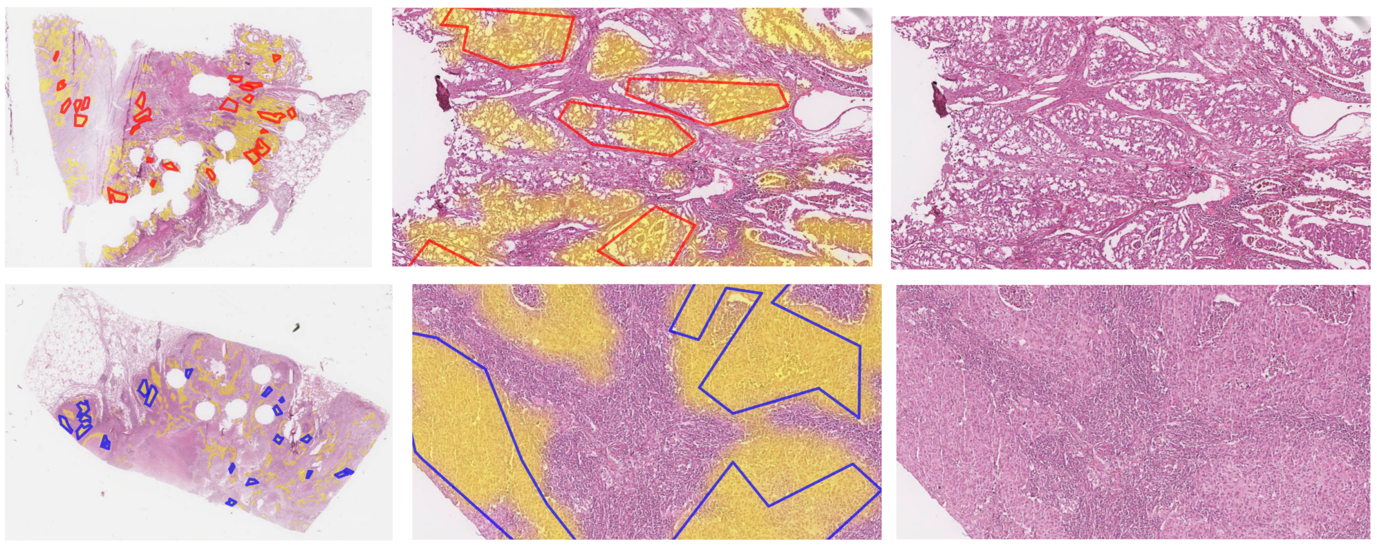 Cancers 14 06181 g003 Cancers 14 06181 g003