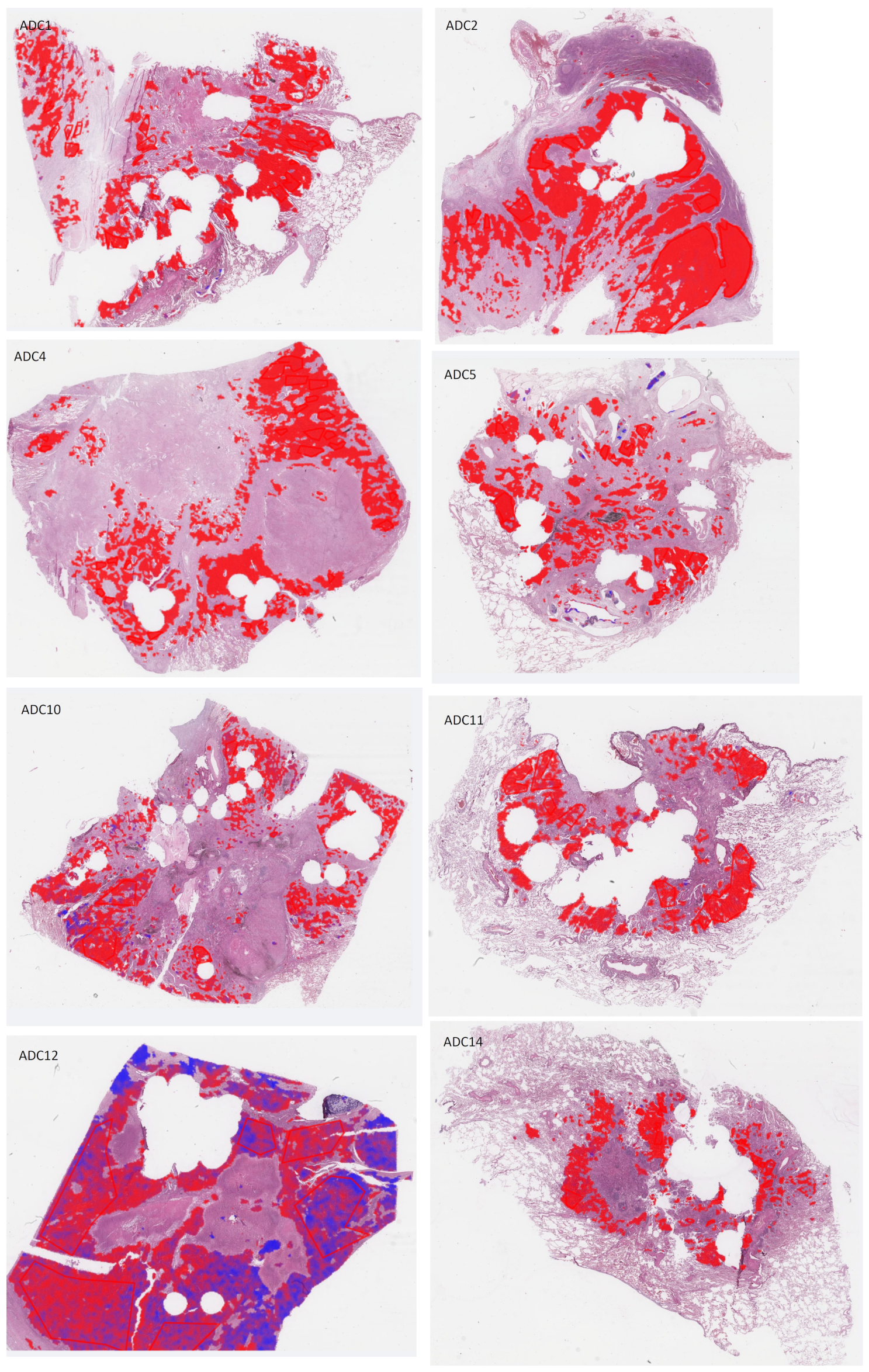 Cancers 14 06181 g0a4a Cancers 14 06181 g0a4a