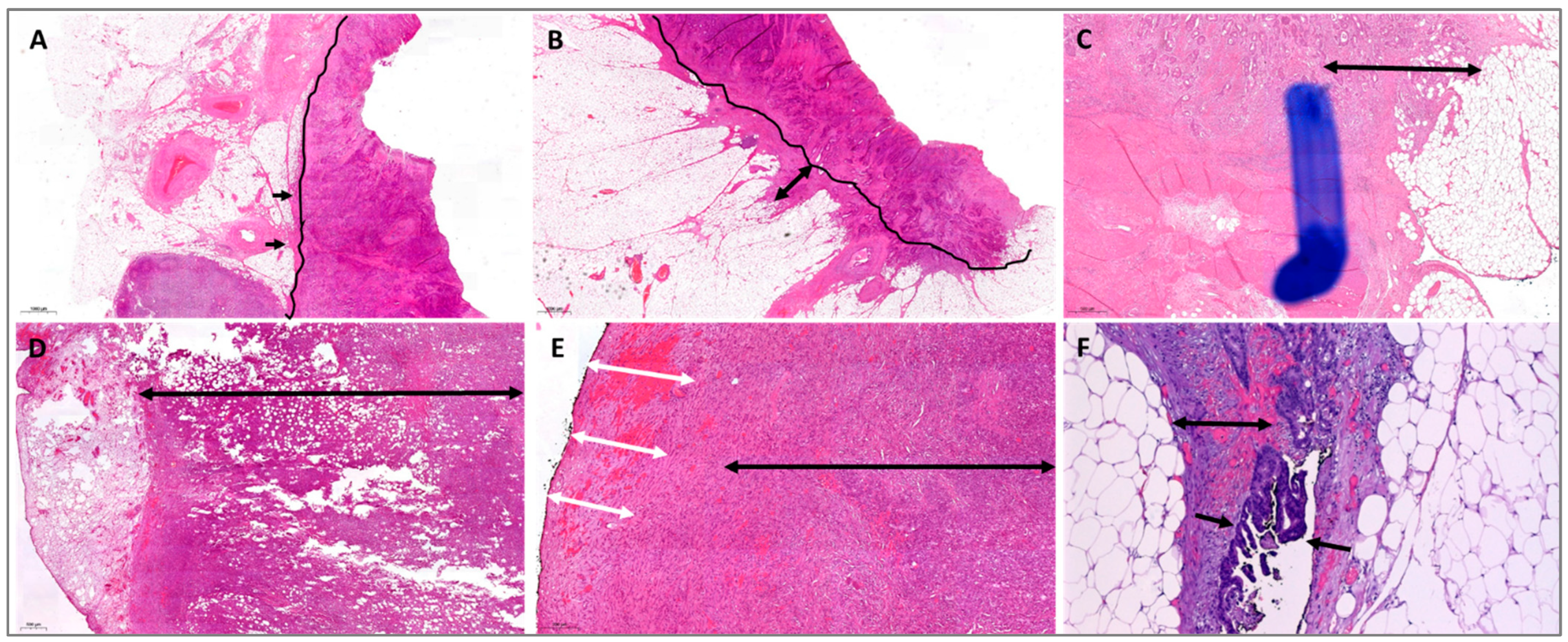 Cancers 14 06186 g001 Cancers 14 06186 g001