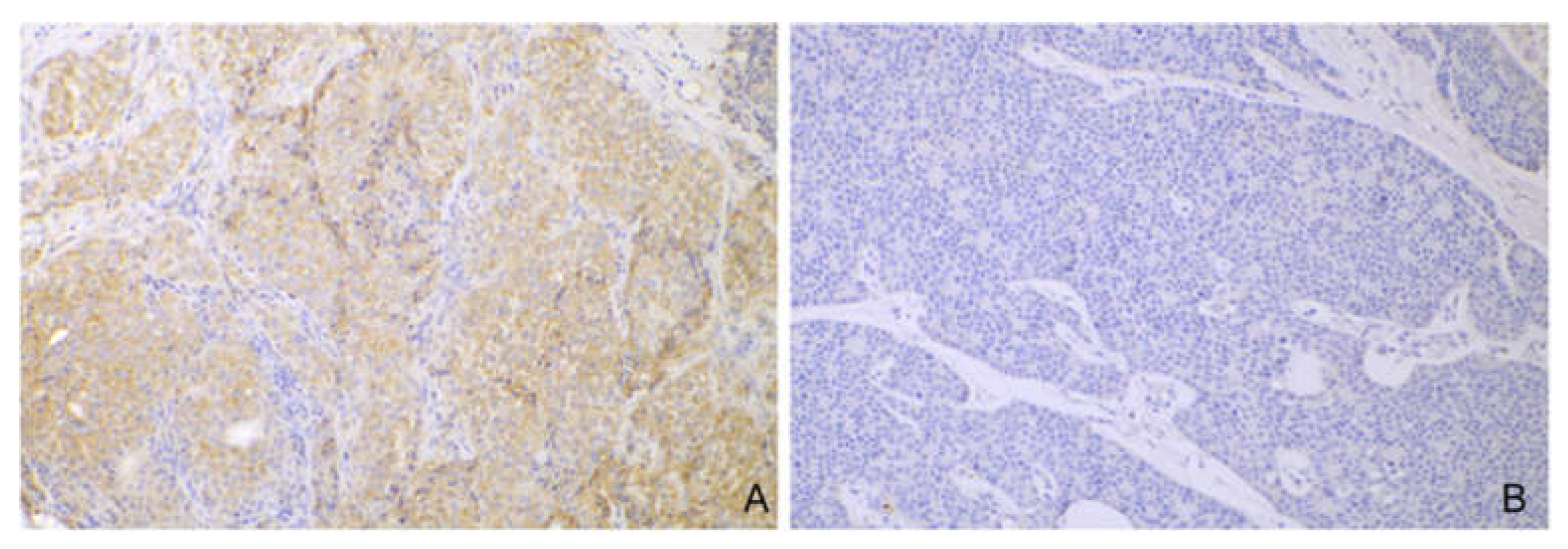 Cancers 14 06188 g002 Cancers 14 06188 g002