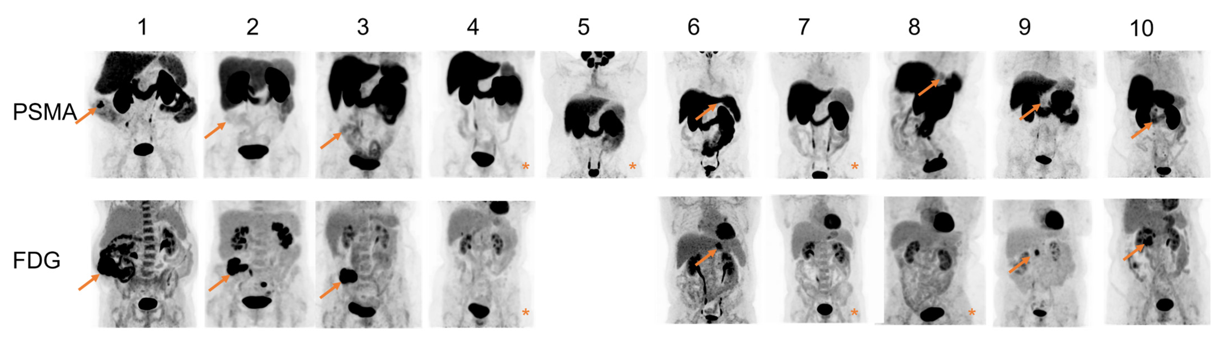 Cancers 14 06209 g004 Cancers 14 06209 g004