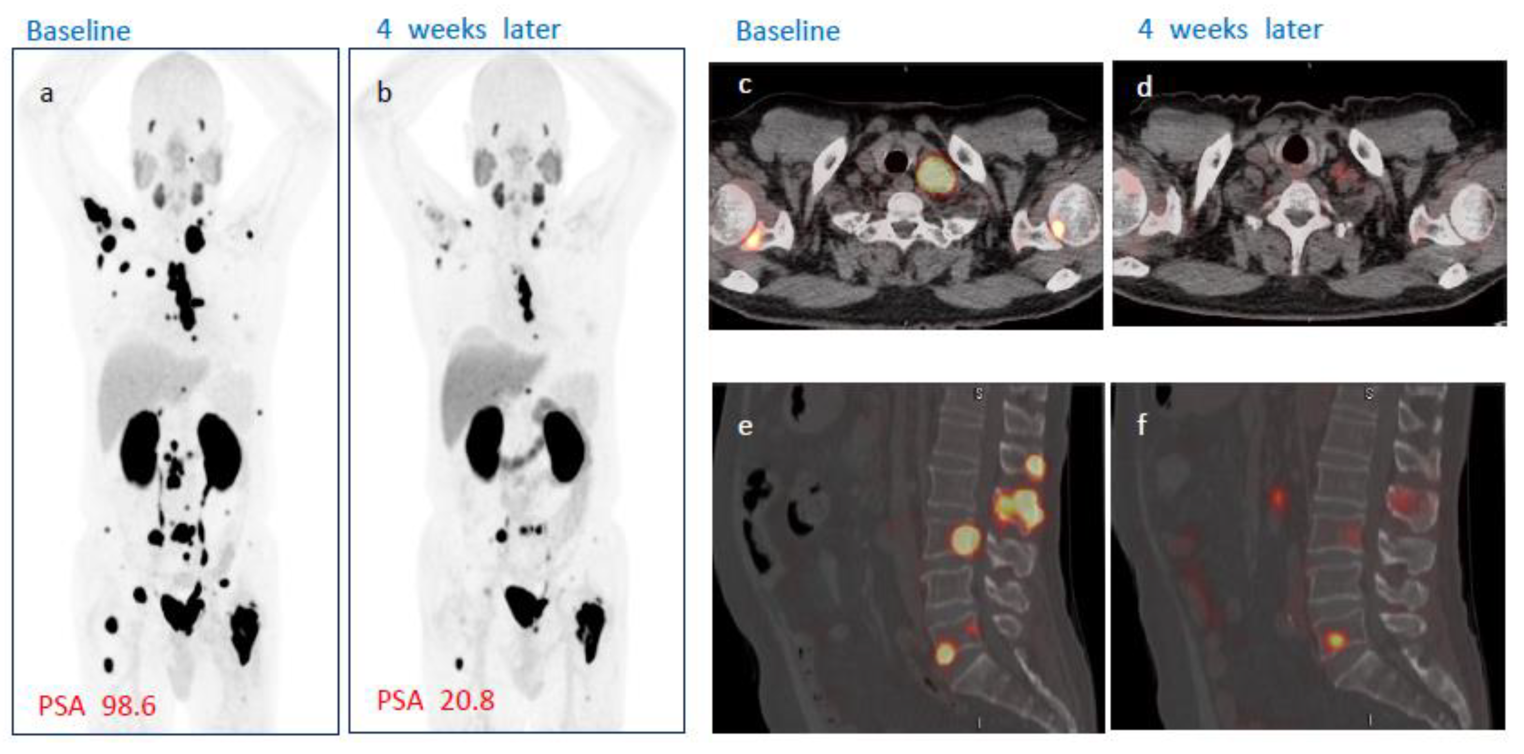 Cancers 14 06225 g004 Cancers 14 06225 g004