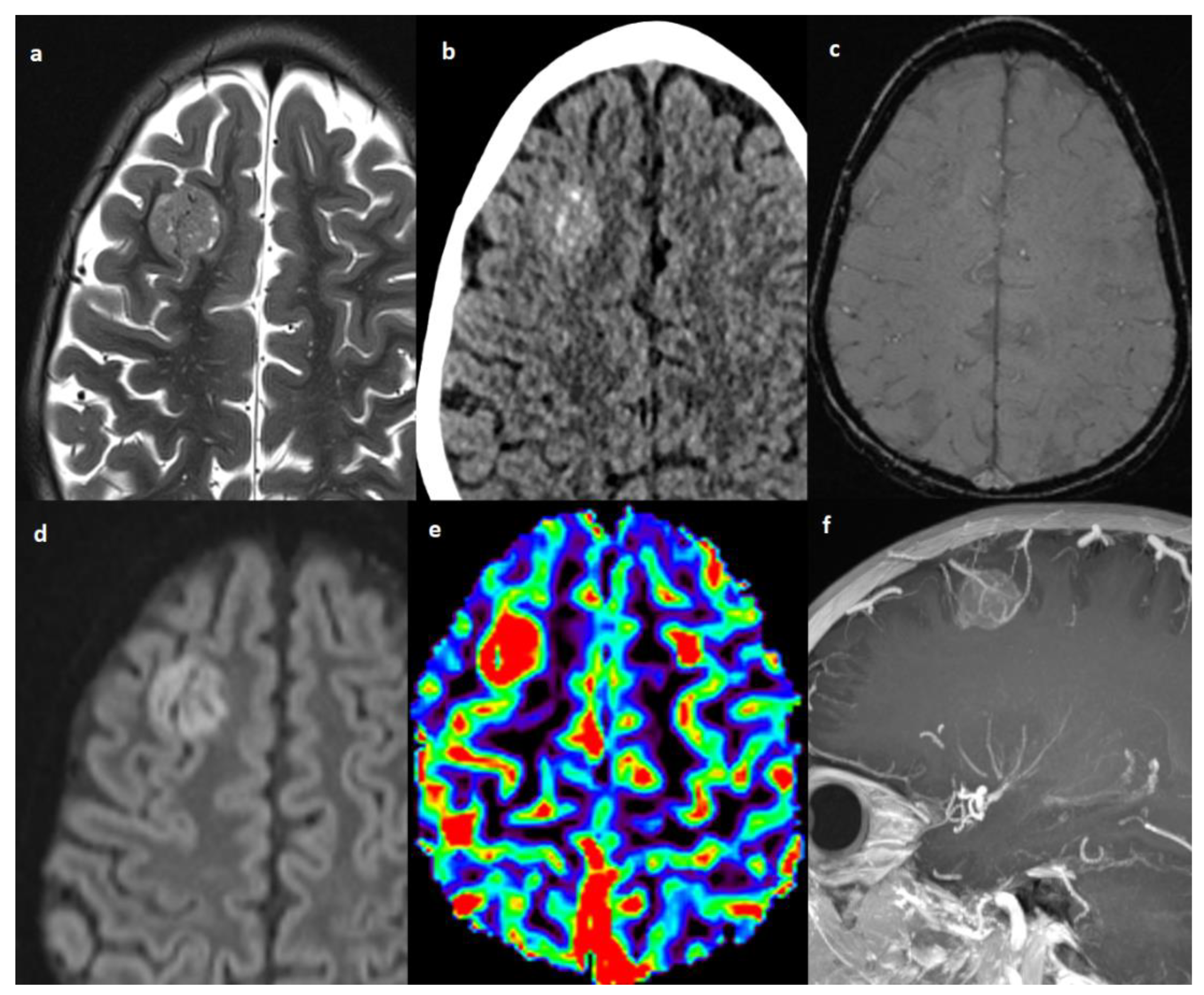 Cancers 14 06249 g003 Cancers 14 06249 g003