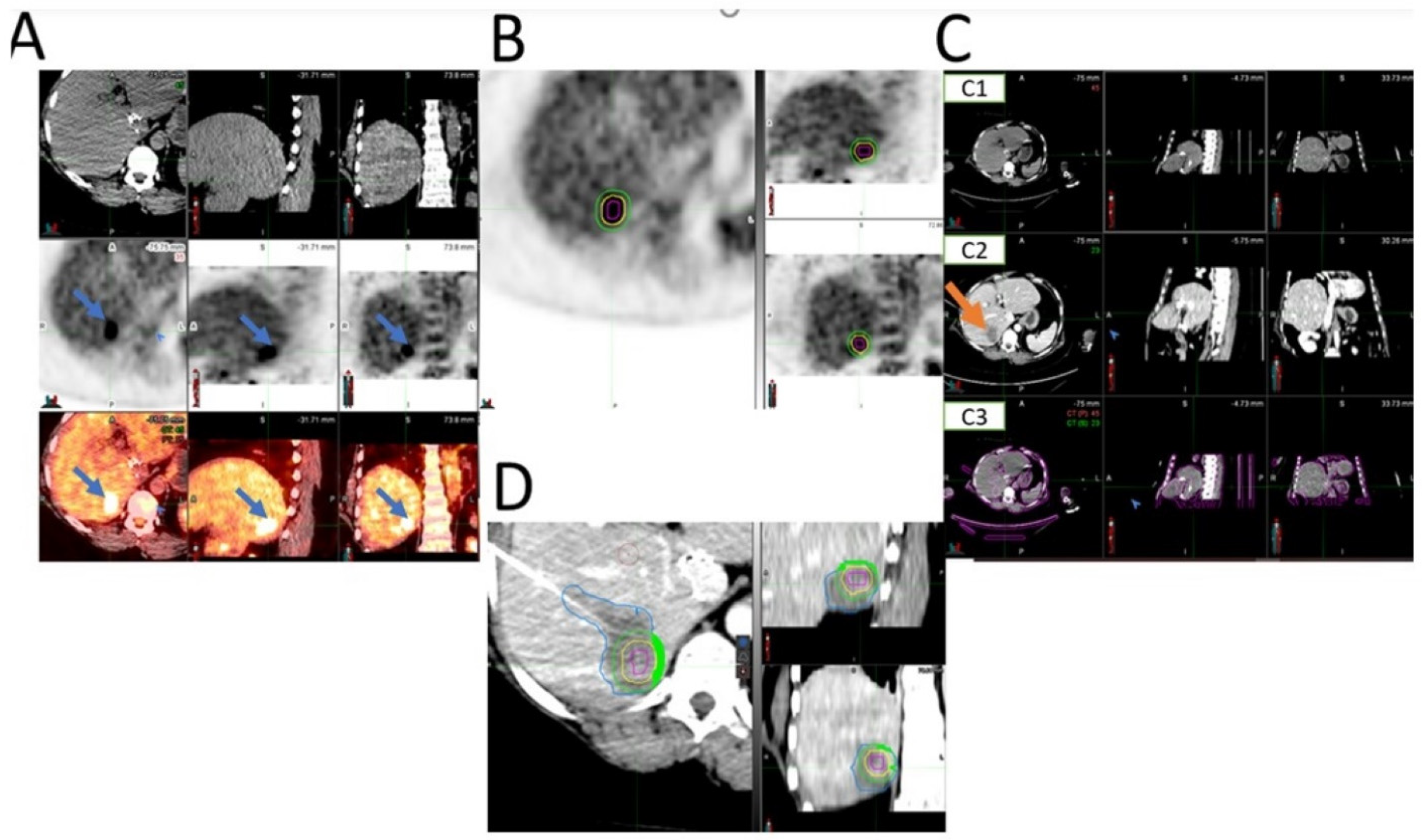 Cancers 14 06253 g003 Cancers 14 06253 g003
