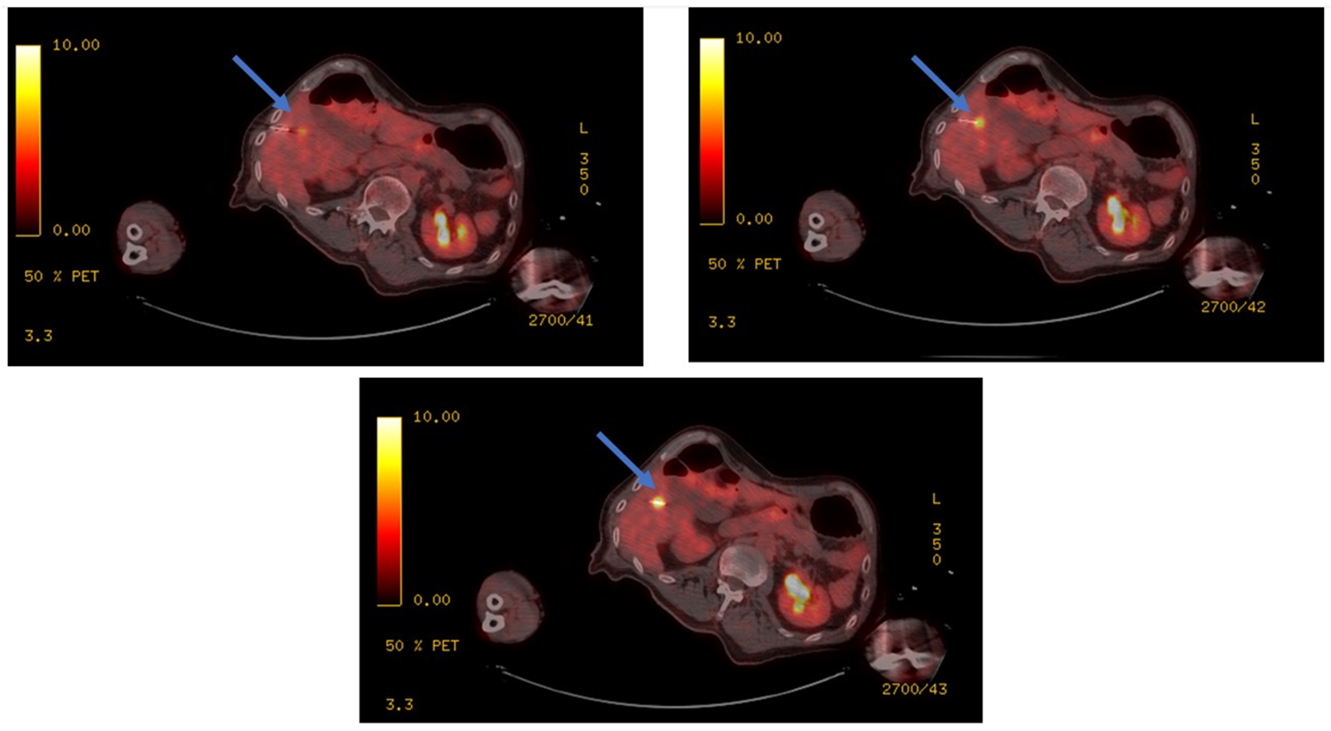 Cancers 14 06253 g006 Cancers 14 06253 g006