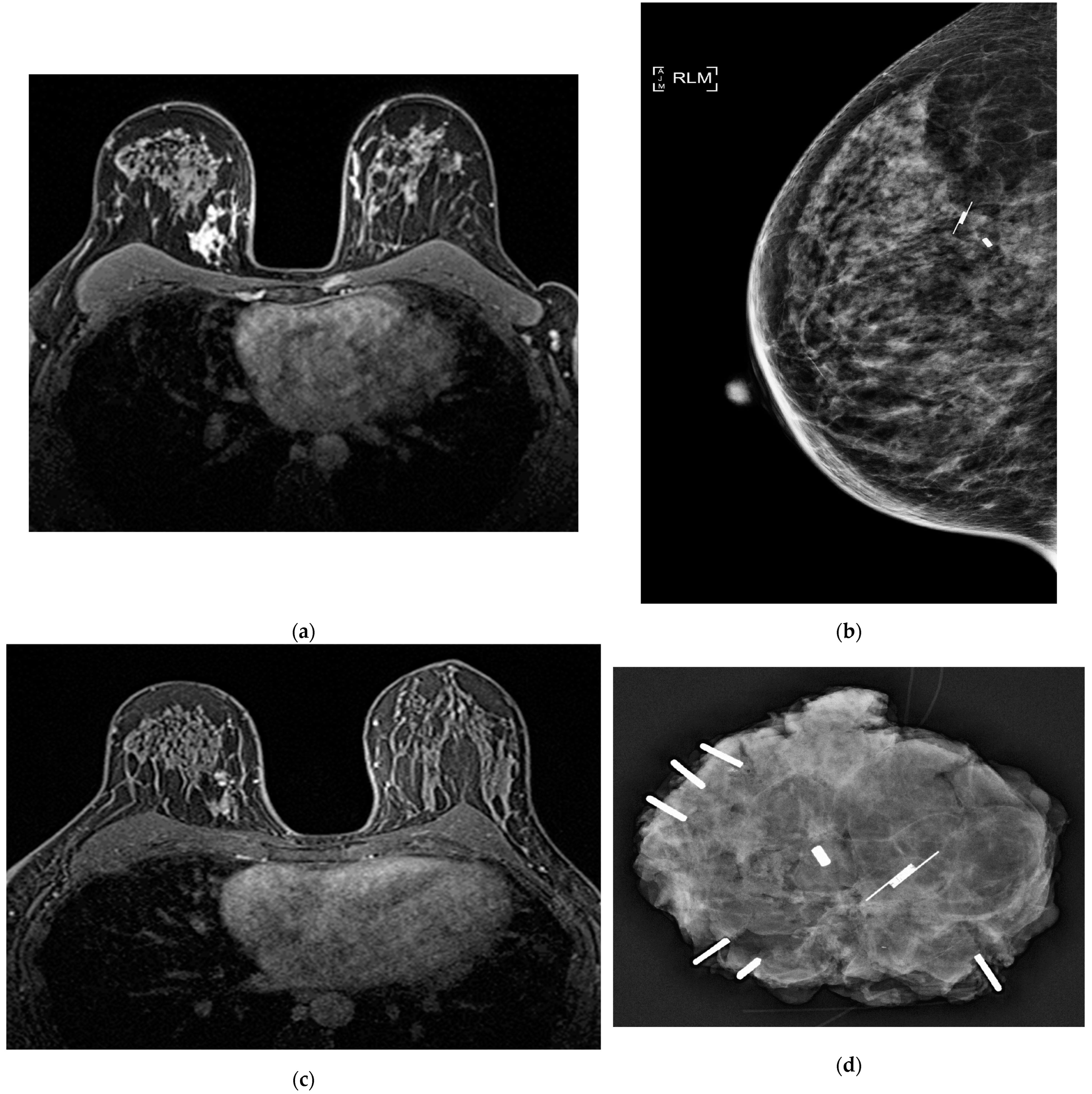 Cancers 15 00013 g001a Cancers 15 00013 g001a