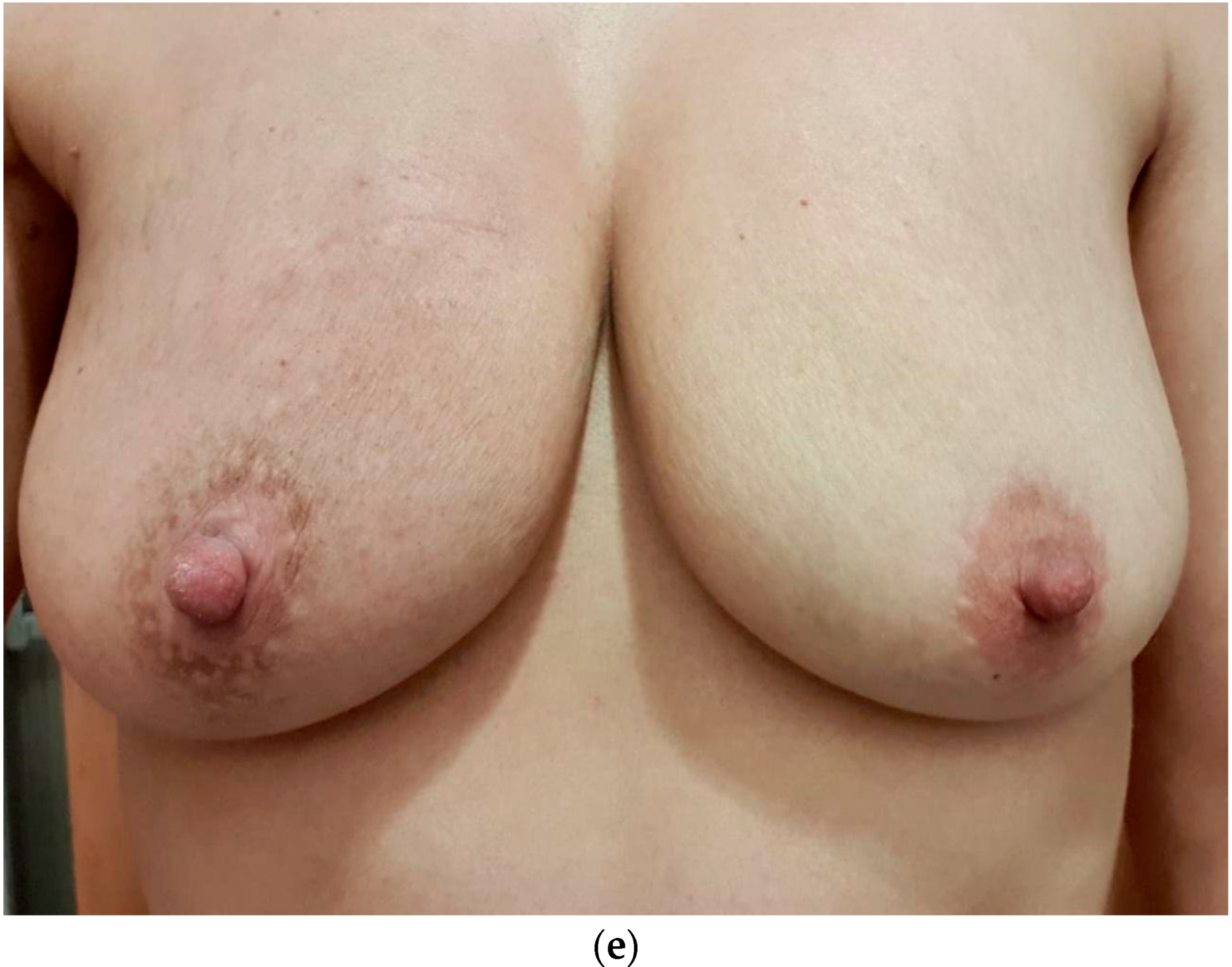 Cancers 15 00013 g001b Cancers 15 00013 g001b