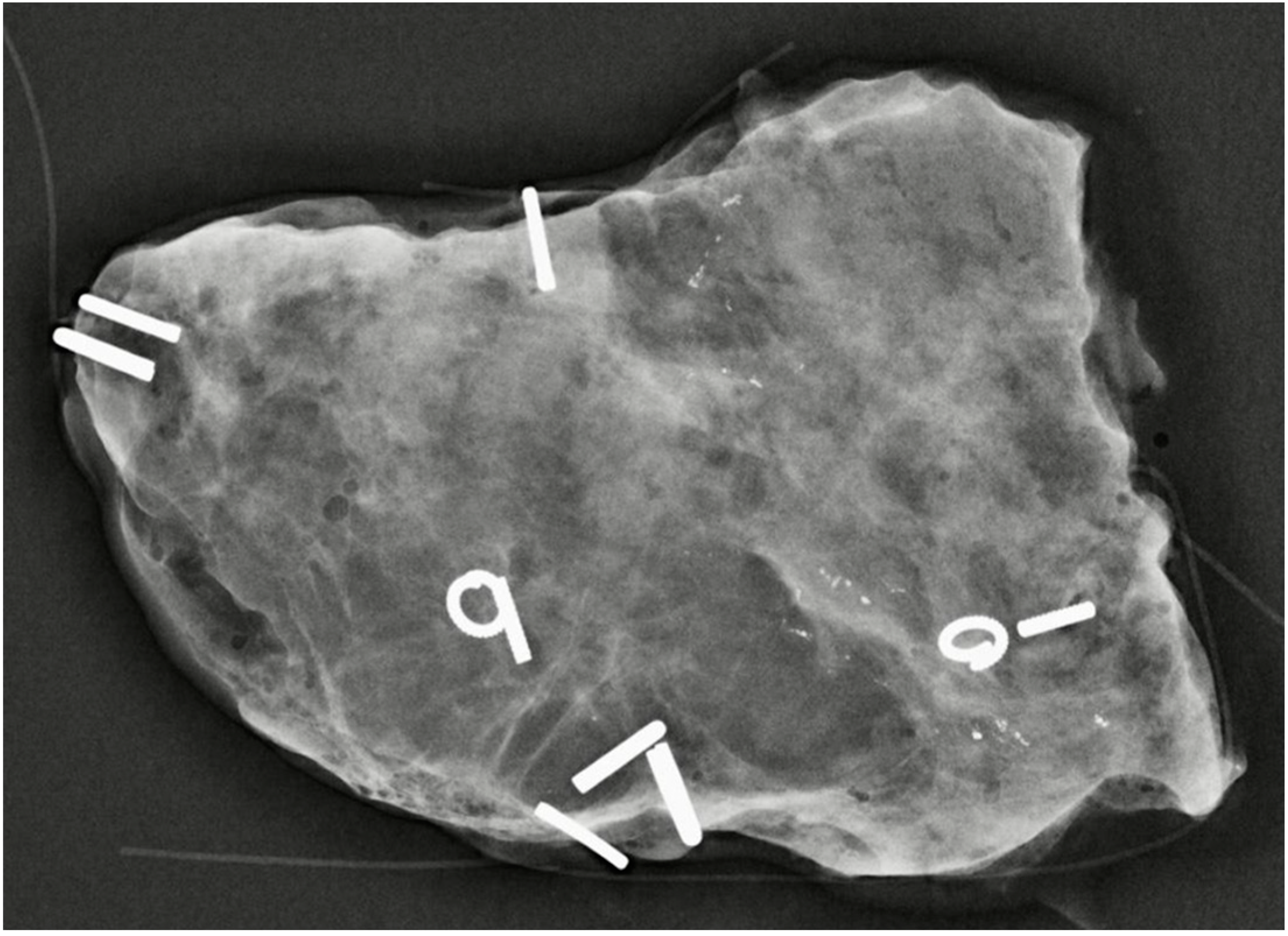 Cancers 15 00013 g002 Cancers 15 00013 g002