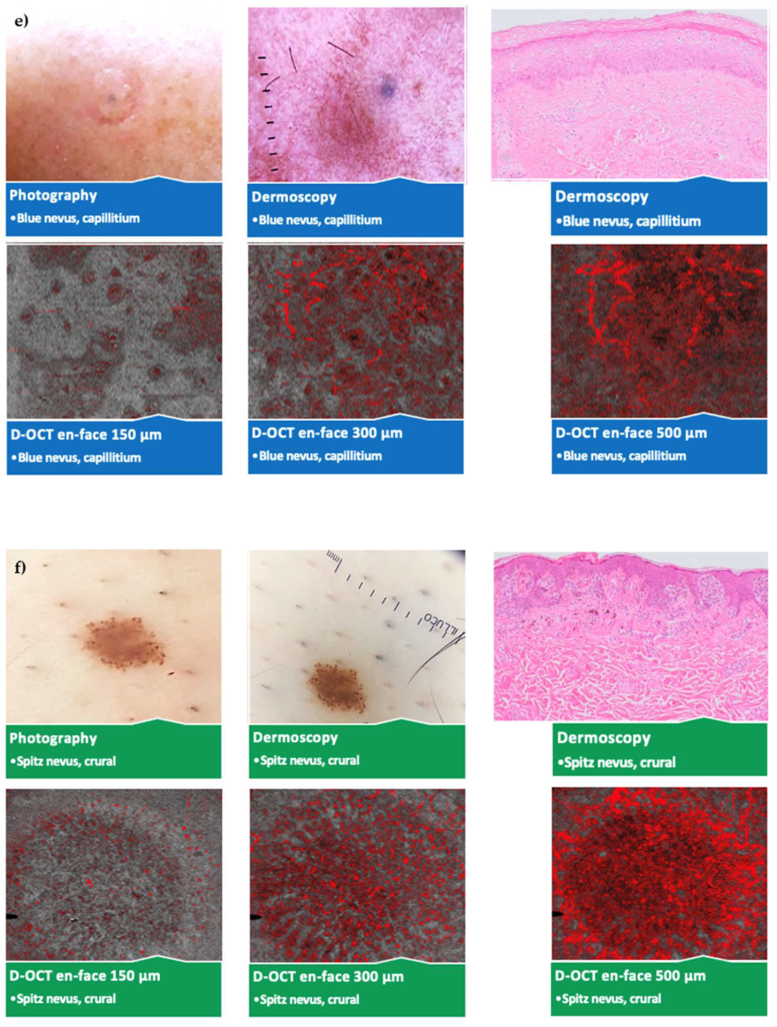 Cancers 15 00020 g004c