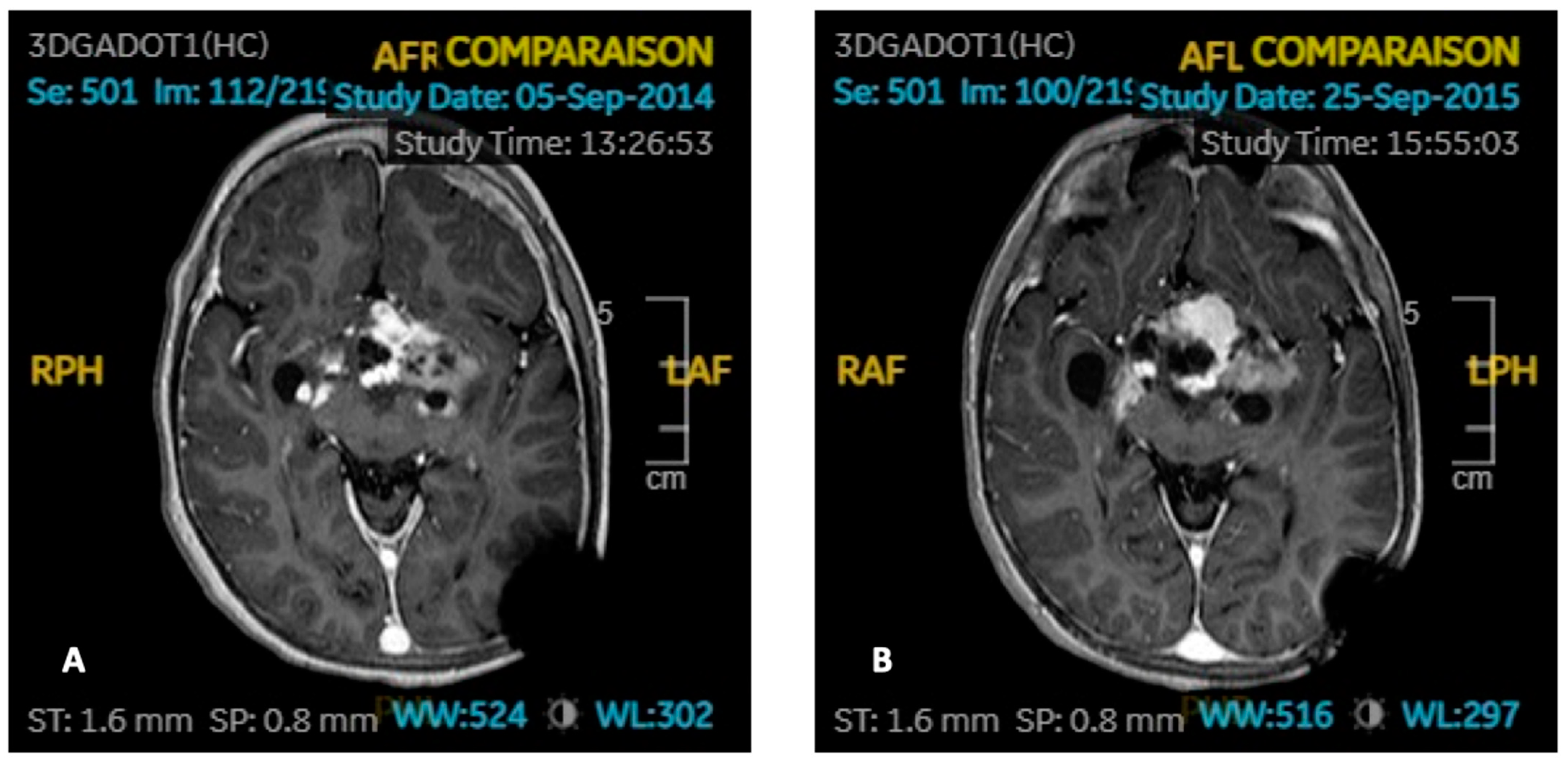 Cancers 15 00055 g003 Cancers 15 00055 g003