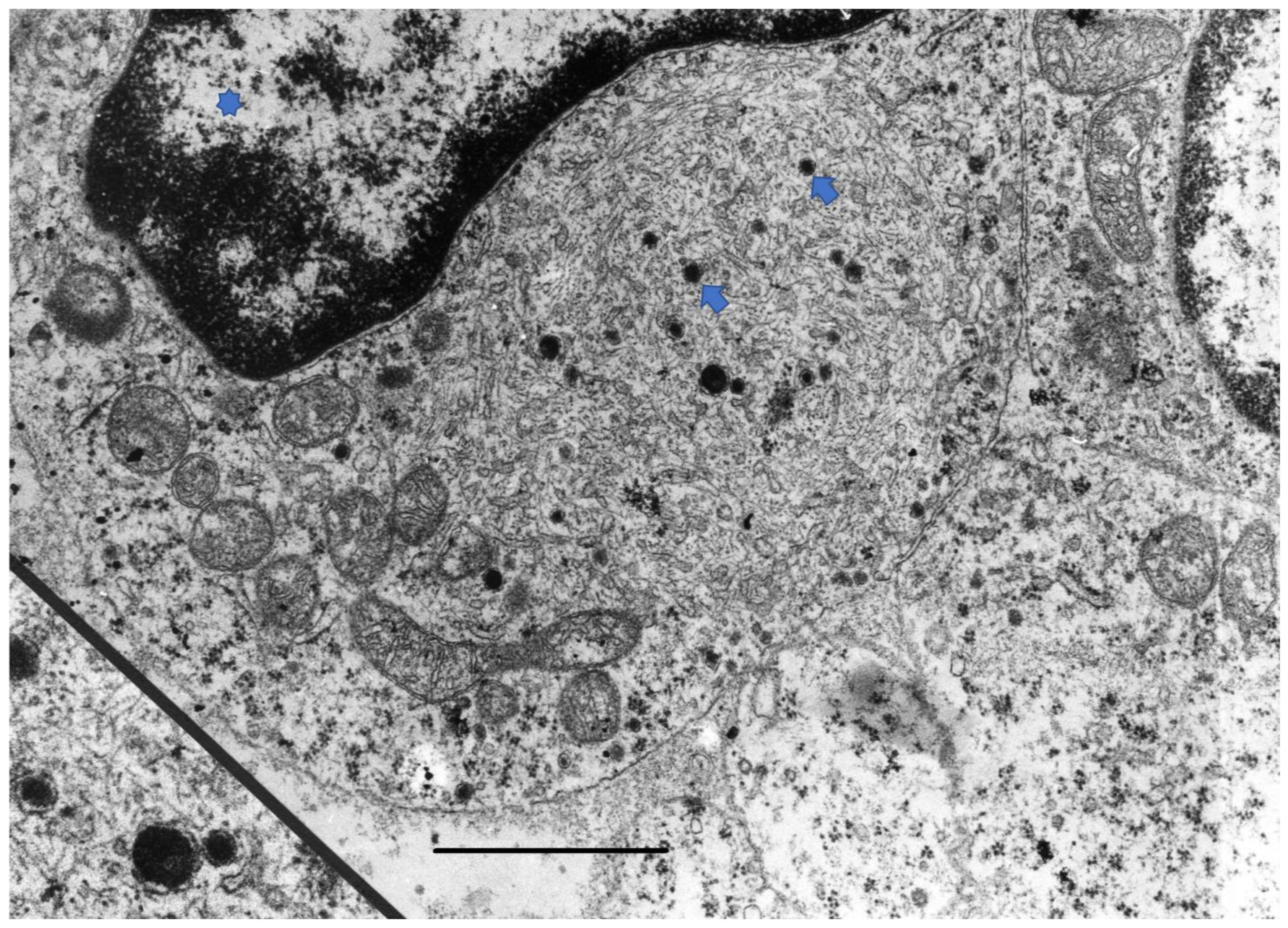 Cancers 15 00103 g003 Cancers 15 00103 g003