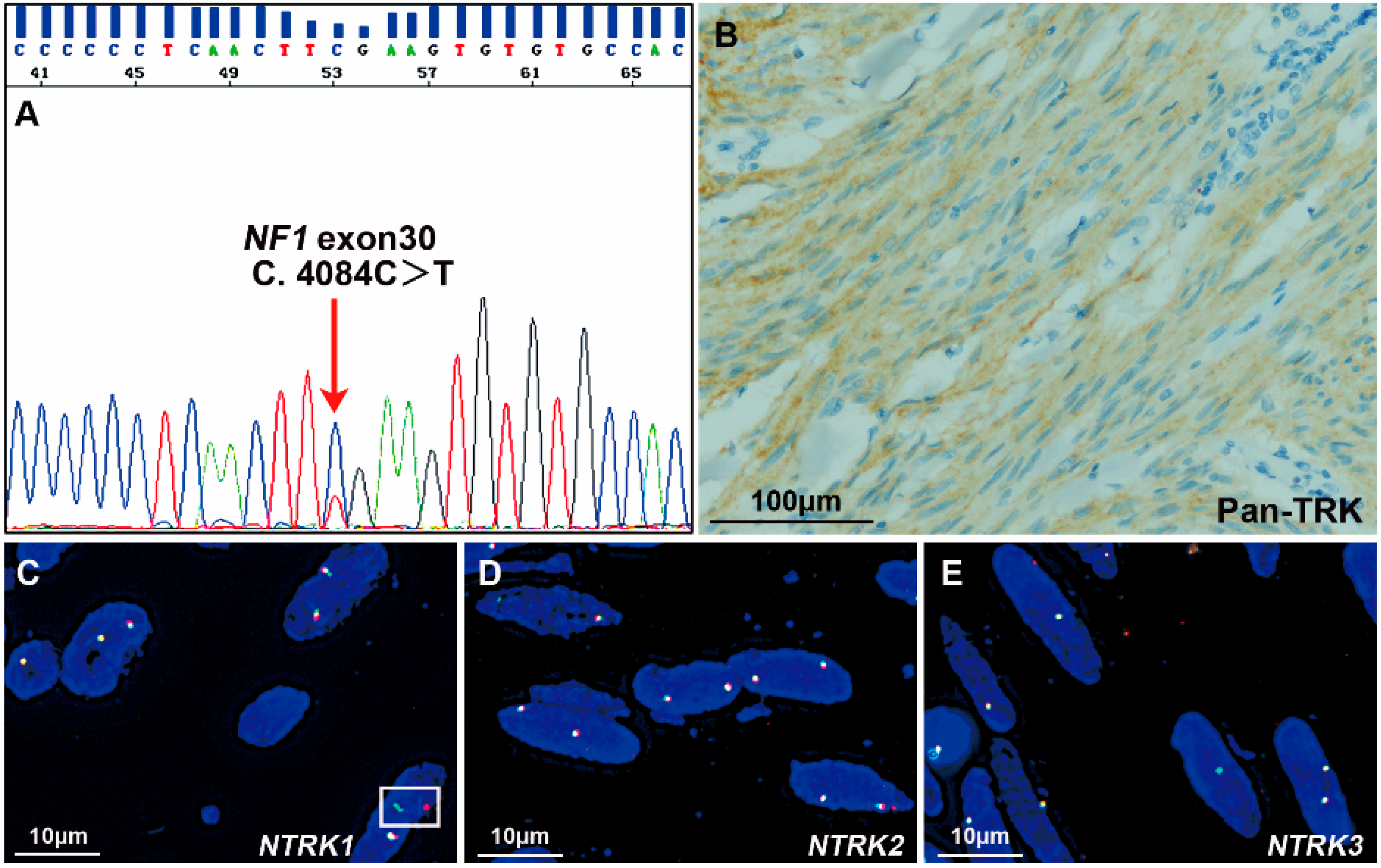 Cancers 15 00105 g004