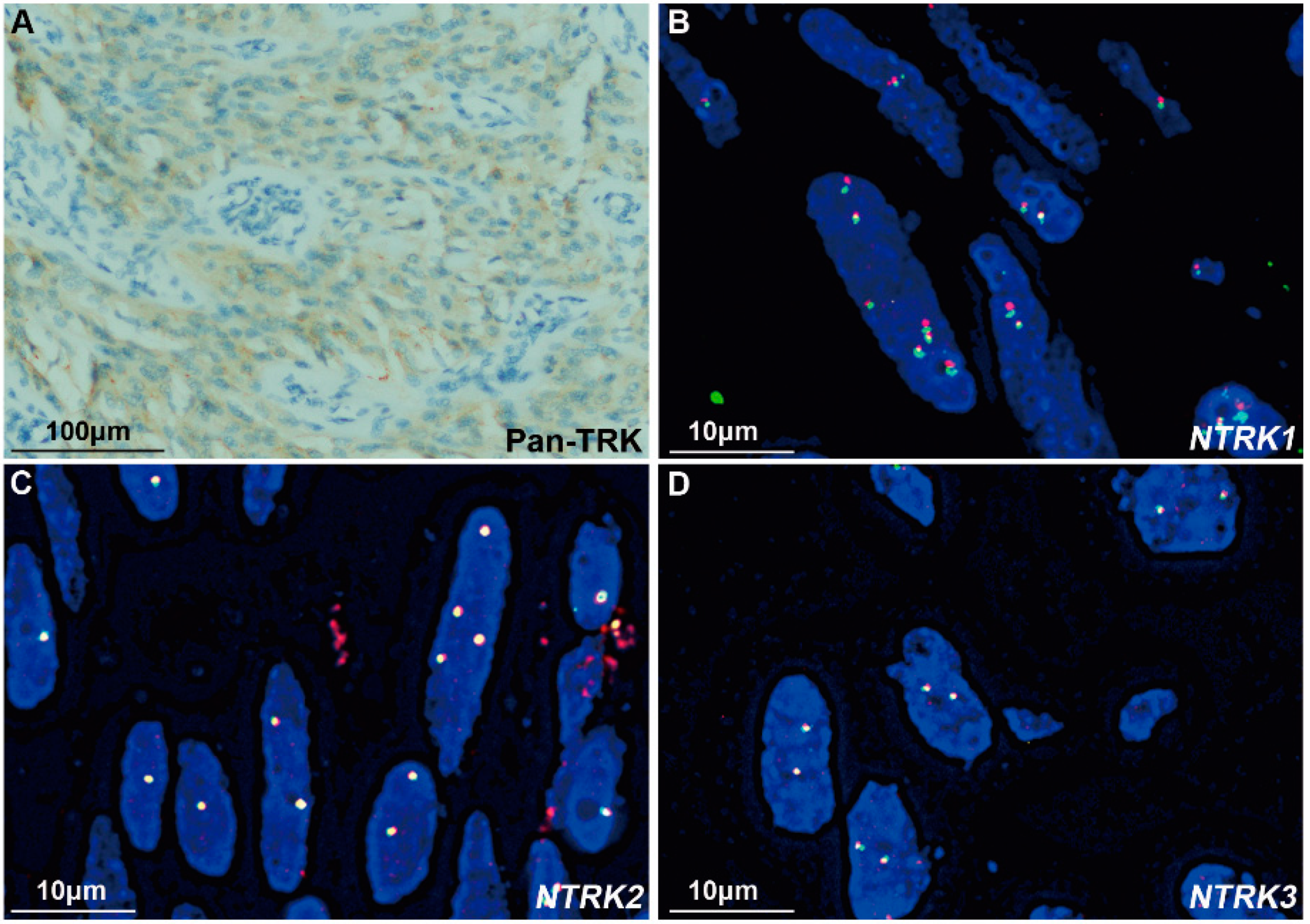 Cancers 15 00105 g006