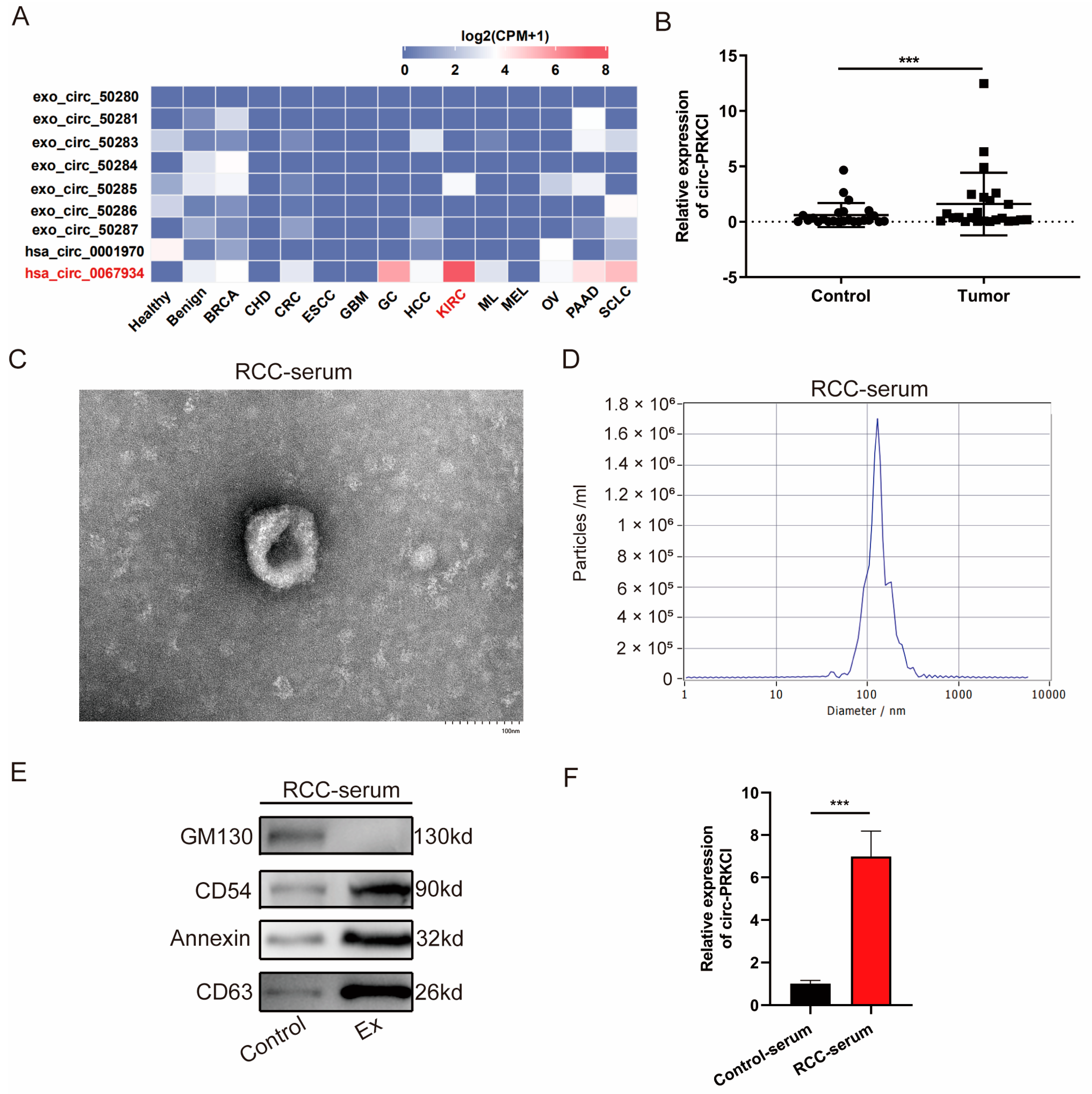 Tumor Cell-Derived Exosomal circ-PRKCI Promotes