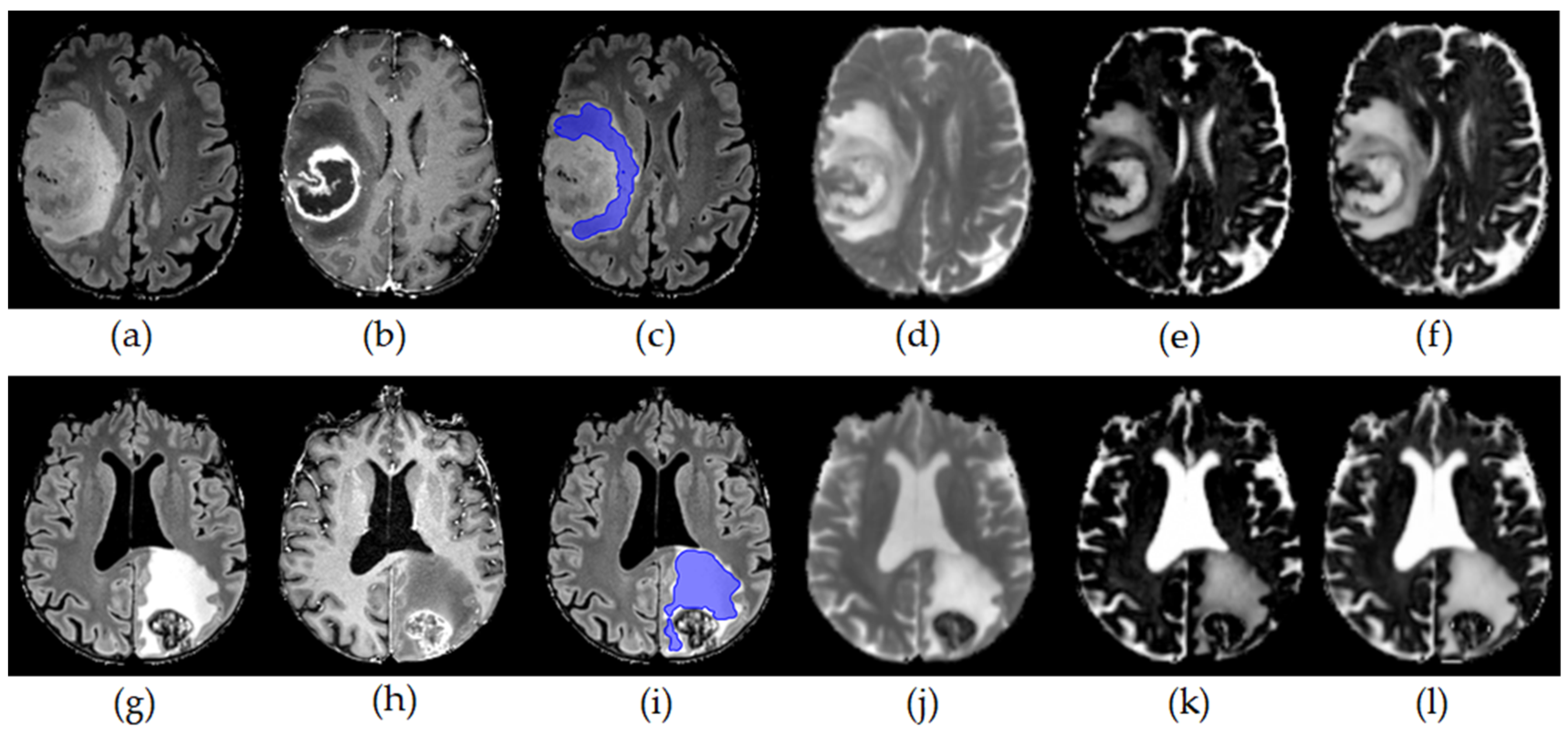 Cancers 15 00129 g001