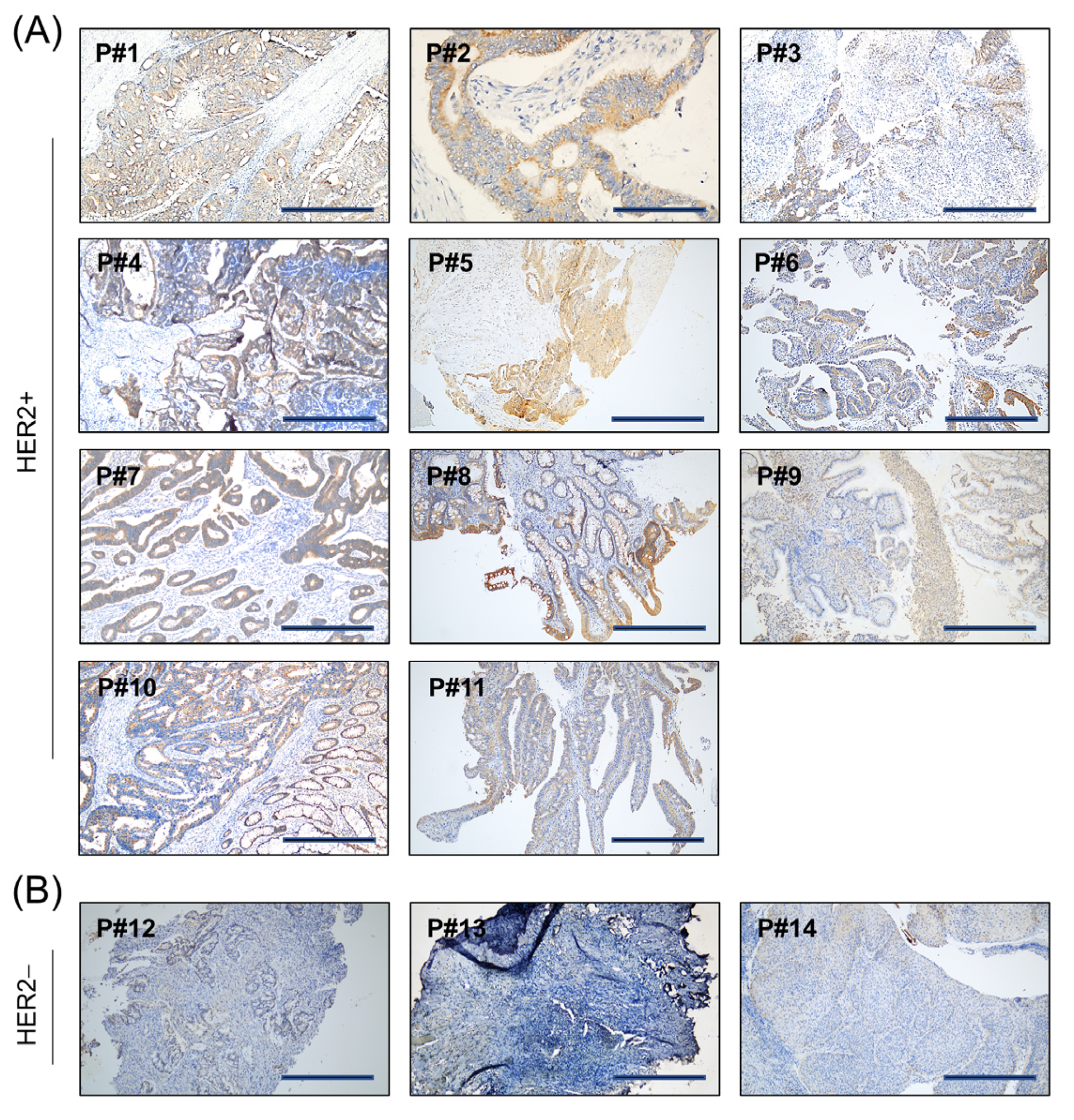 Cancers 15 00130 g003