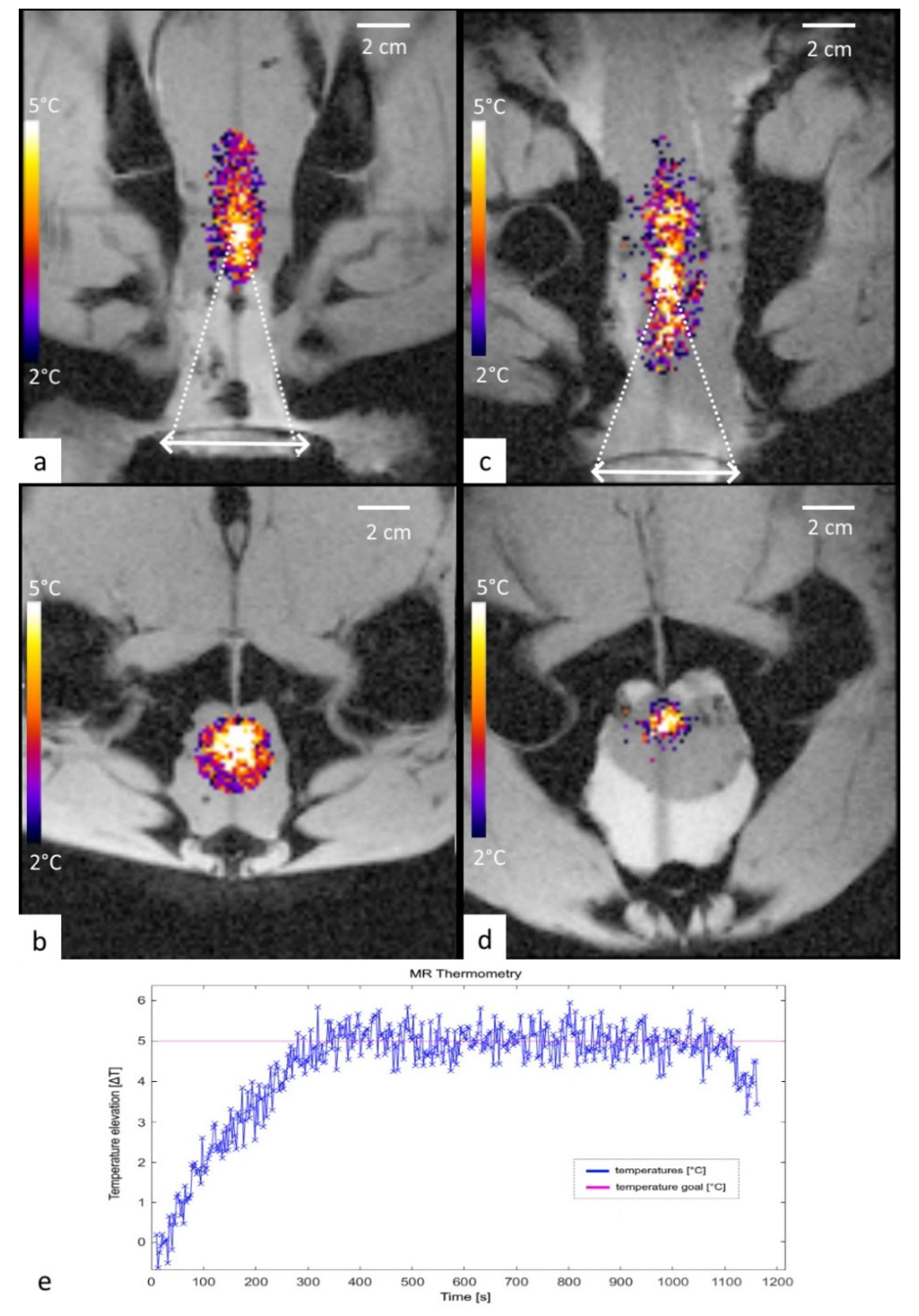 Cancers 15 00163 g006 Cancers 15 00163 g006