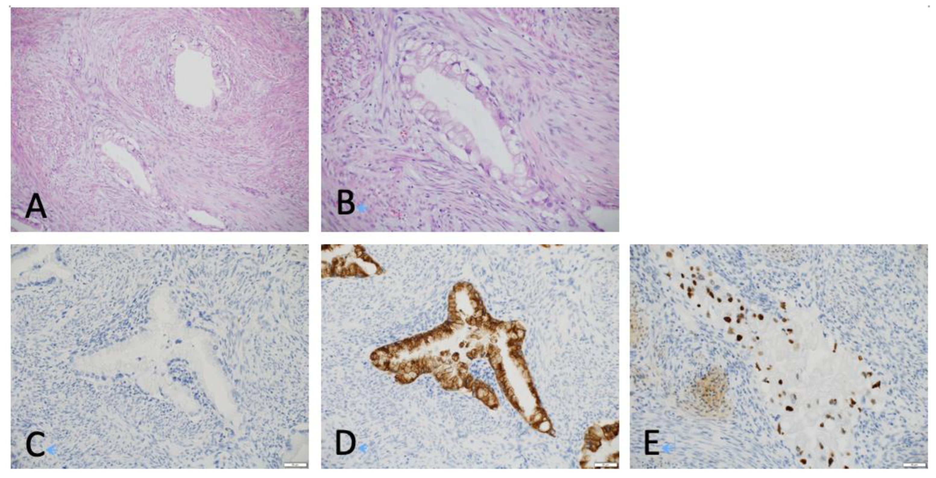 Cancers 15 00170 g002 Cancers 15 00170 g002