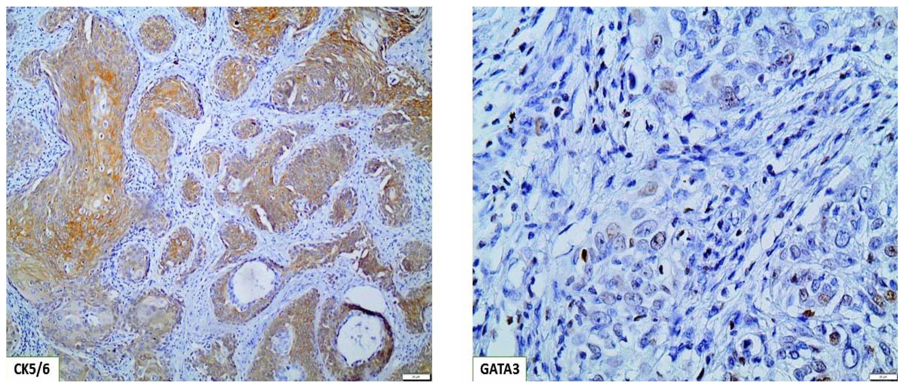 Cancers 15 00188 g003 Cancers 15 00188 g003