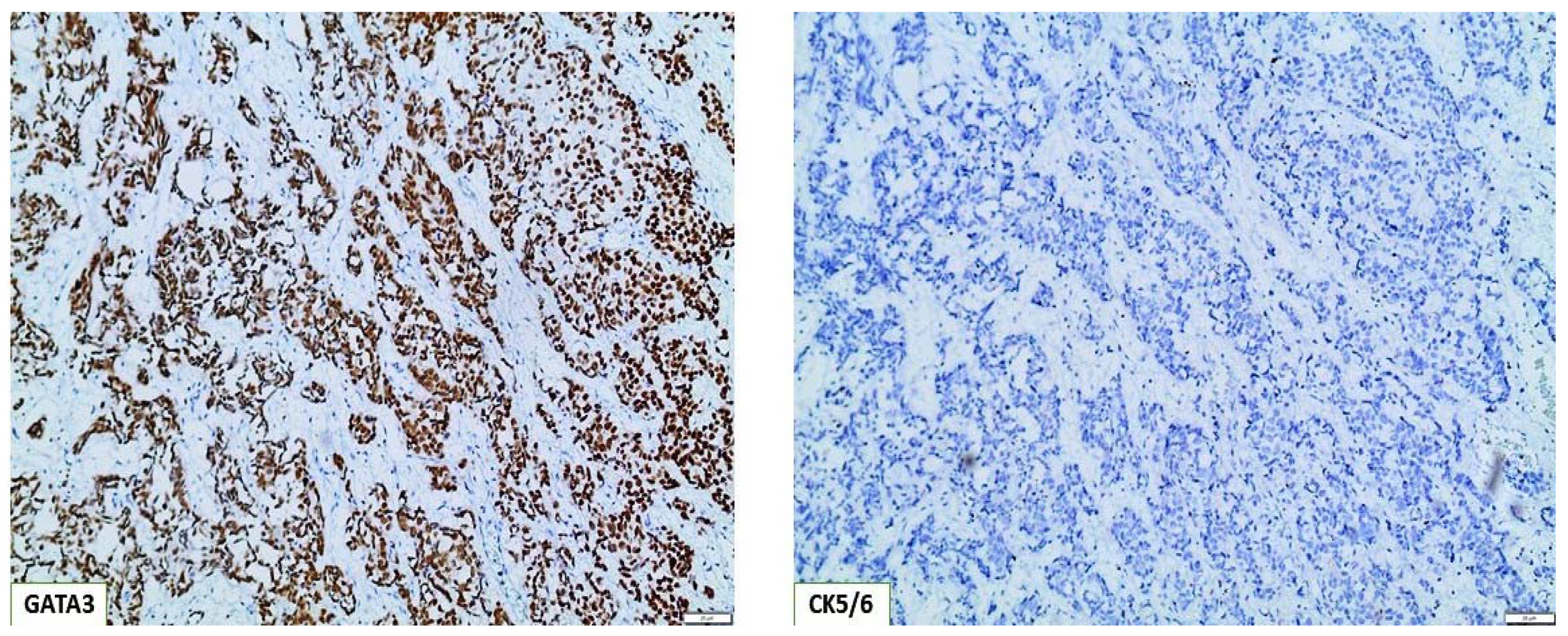 Cancers 15 00188 g004 Cancers 15 00188 g004