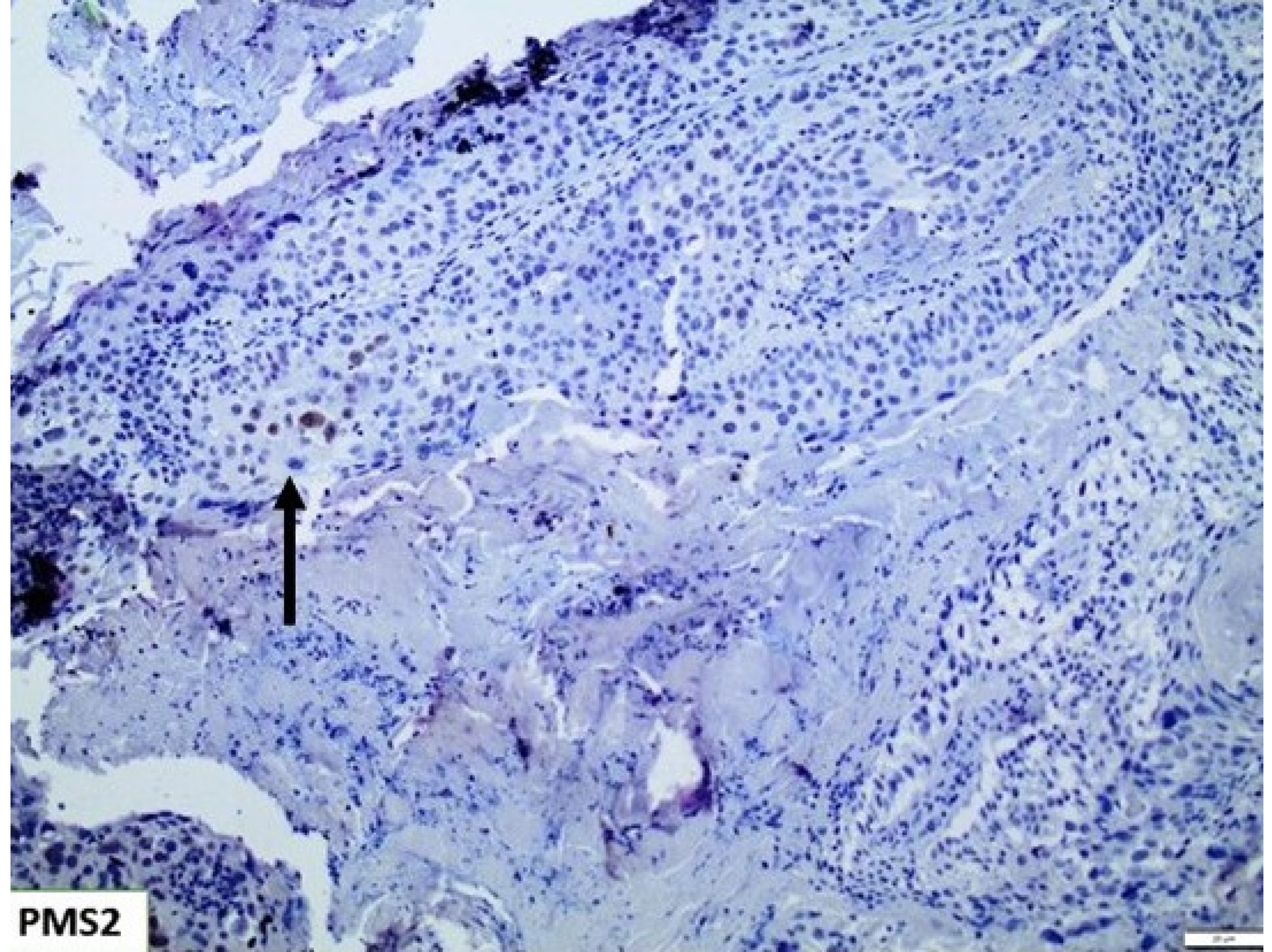 Cancers 15 00188 g005 Cancers 15 00188 g005